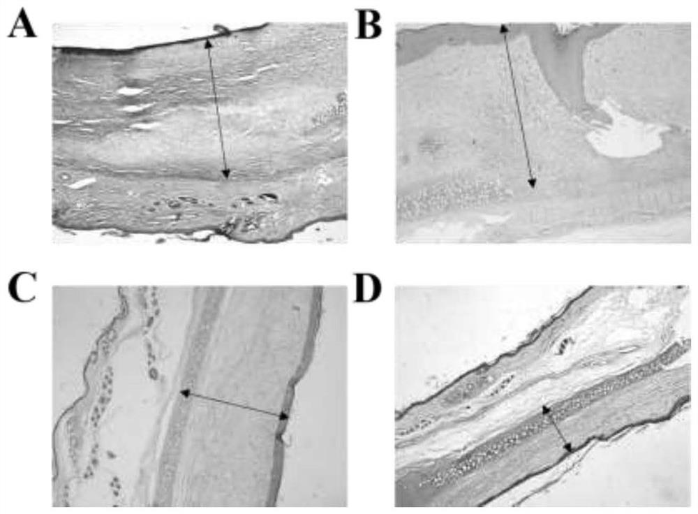 A kind of anti-opal film for inhibiting scar generation and its preparation method