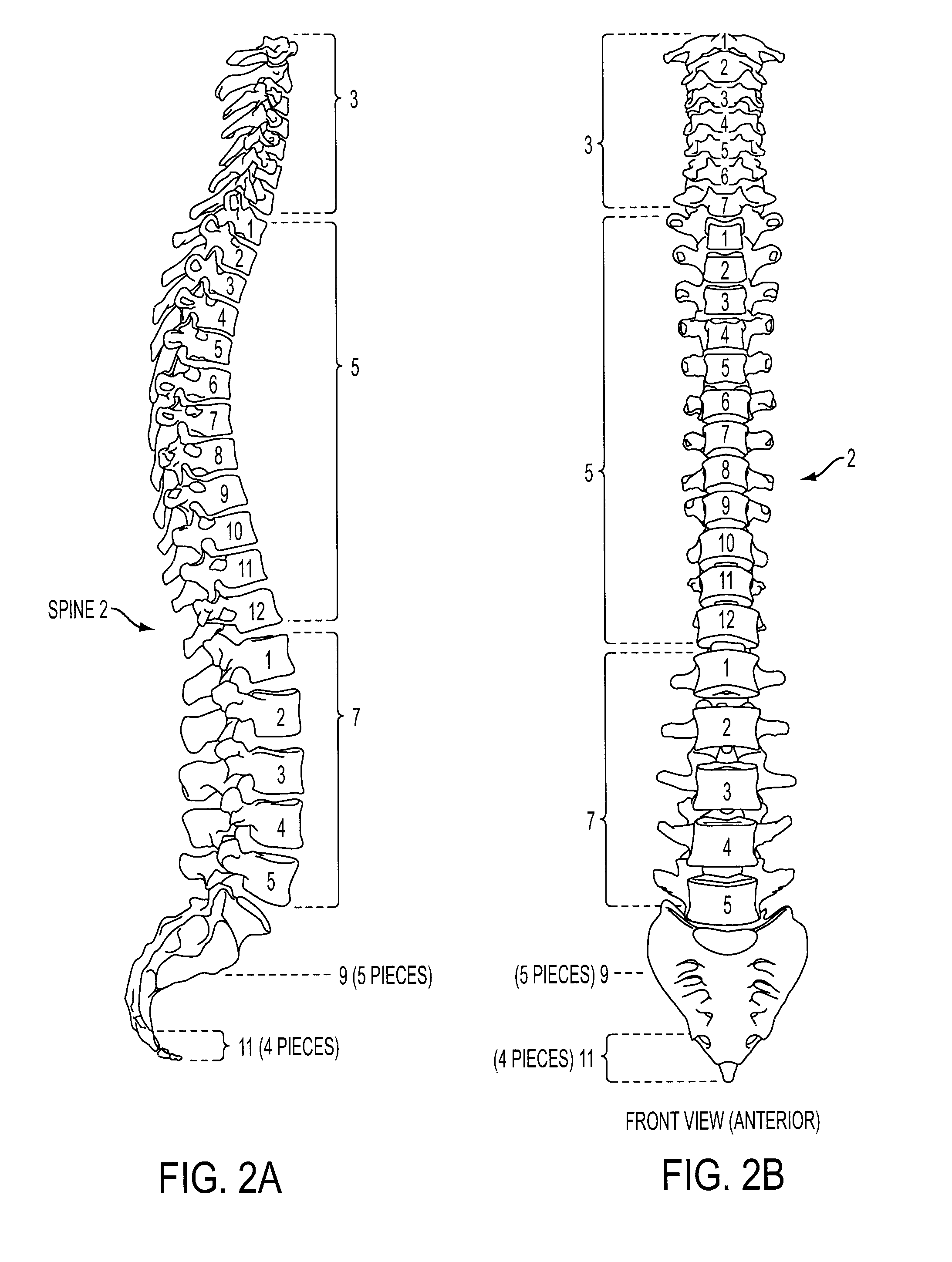 Expandable Intervertebral Prosthesis Device for Posterior Implantation and Related Method Thereof