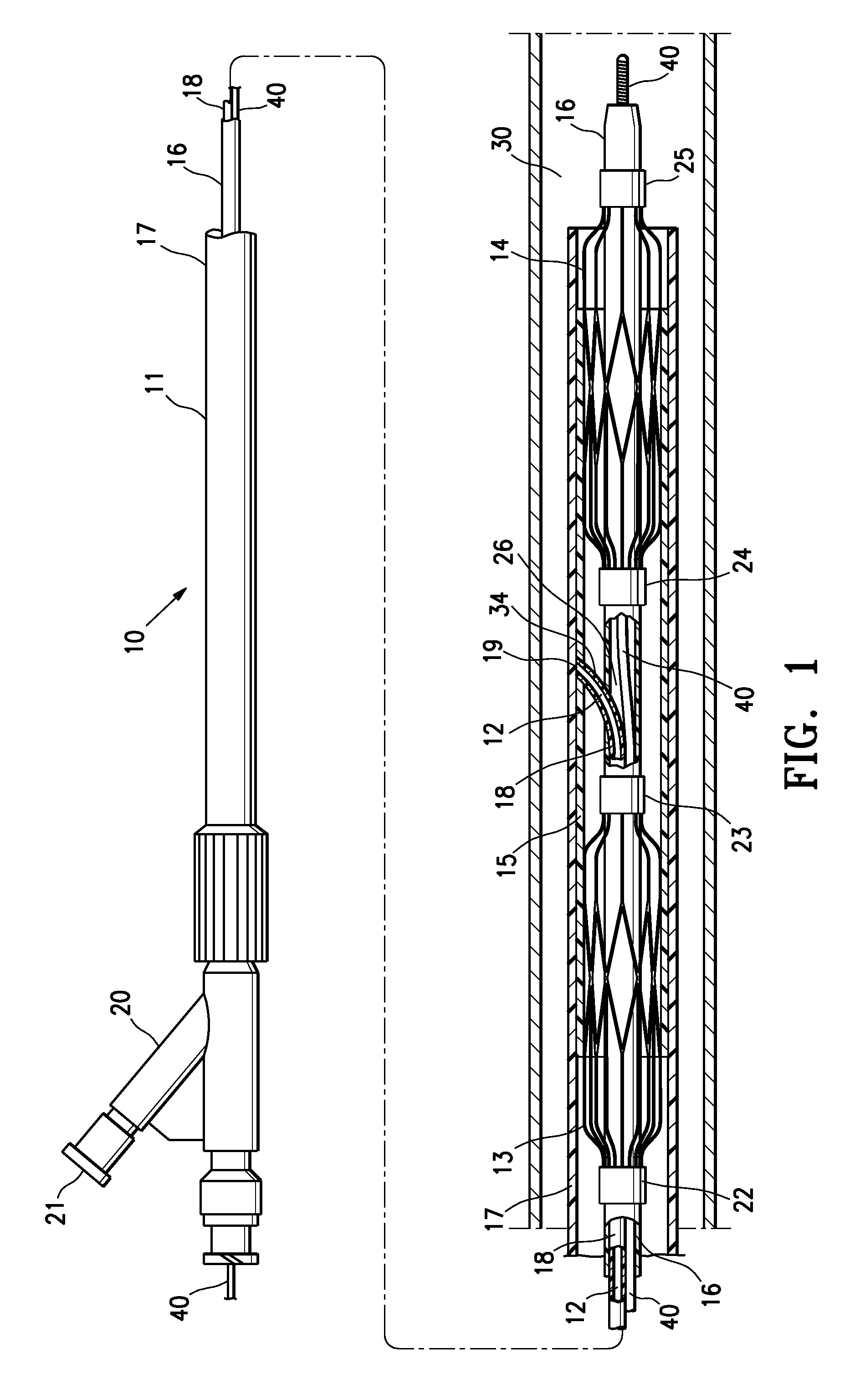 Low profile agent delivery perfusion catheter having reversibly expanding frames