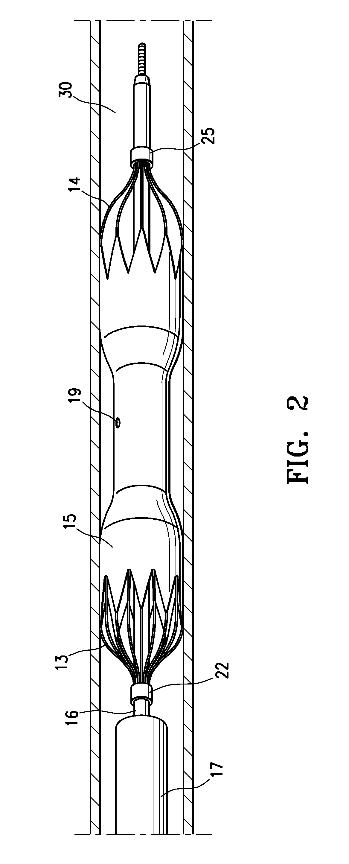 Low profile agent delivery perfusion catheter having reversibly expanding frames