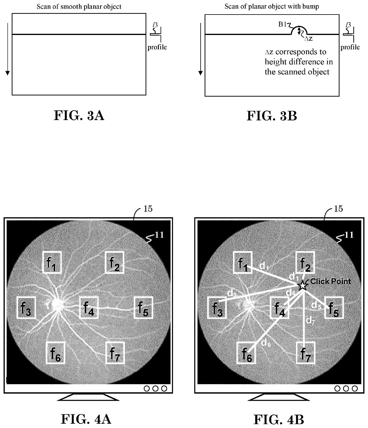 A patient tuned ophthalmic imaging system with single exposure multi-type imaging, improved focusing, and improved angiography image sequence display