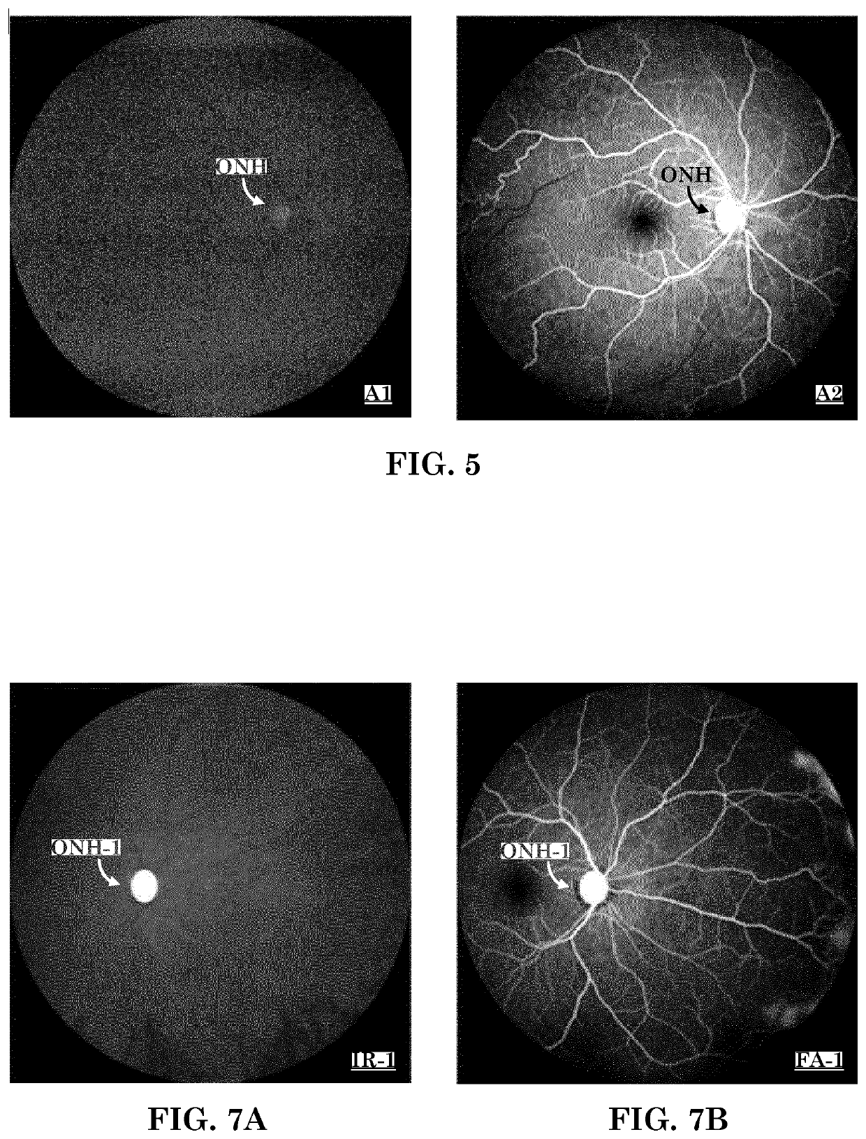 A patient tuned ophthalmic imaging system with single exposure multi-type imaging, improved focusing, and improved angiography image sequence display