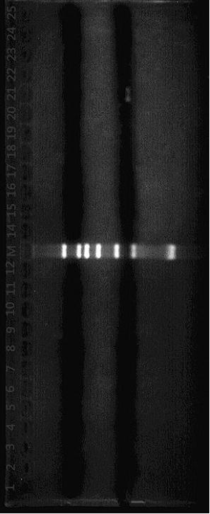 A real-time fluorescent quantitative PCR kit for detection of Enterobacter aerogenes