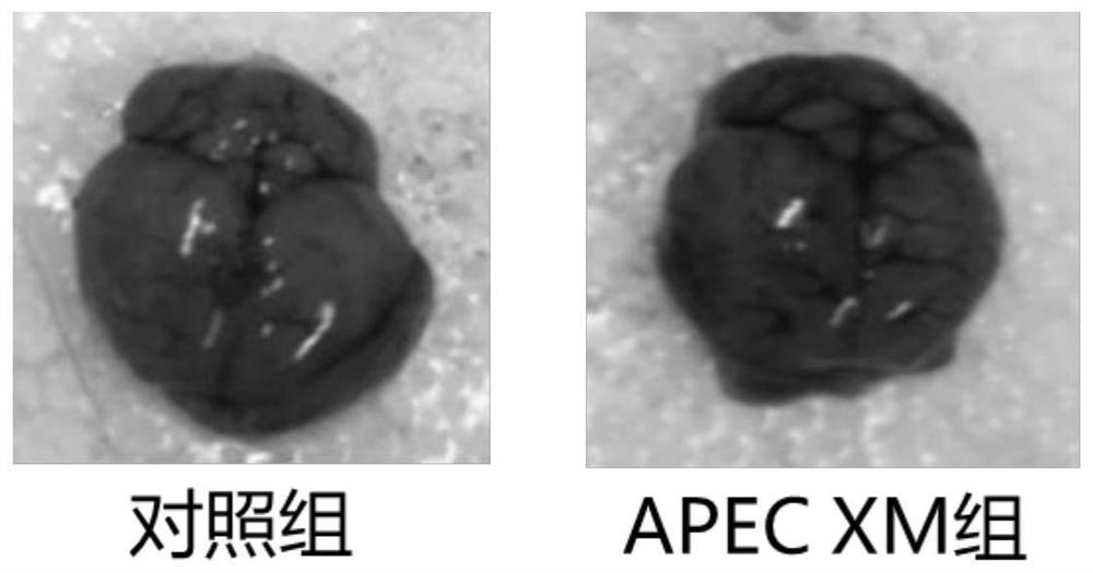 Application of a drug instead of antibiotics--melatonin against meningitis Escherichia coli pathogenic infection in children