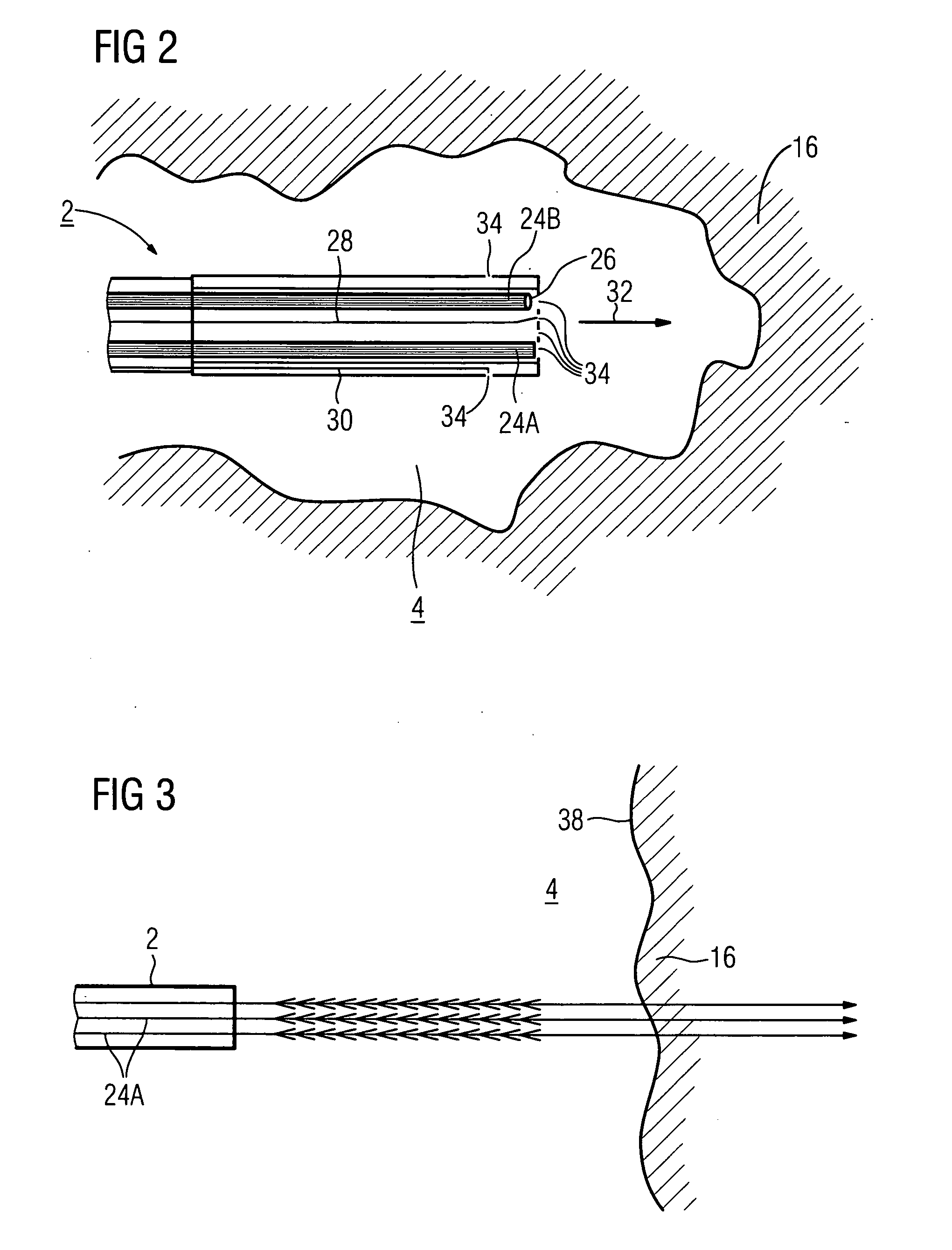 Method for medical imaging and a medical imaging system