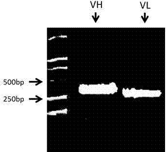 Human body beta-amyloid protein detection kit and application thereof
