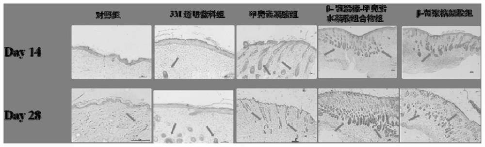 Hydrogel composition for inhibiting scar formation as well as preparation method and application thereof