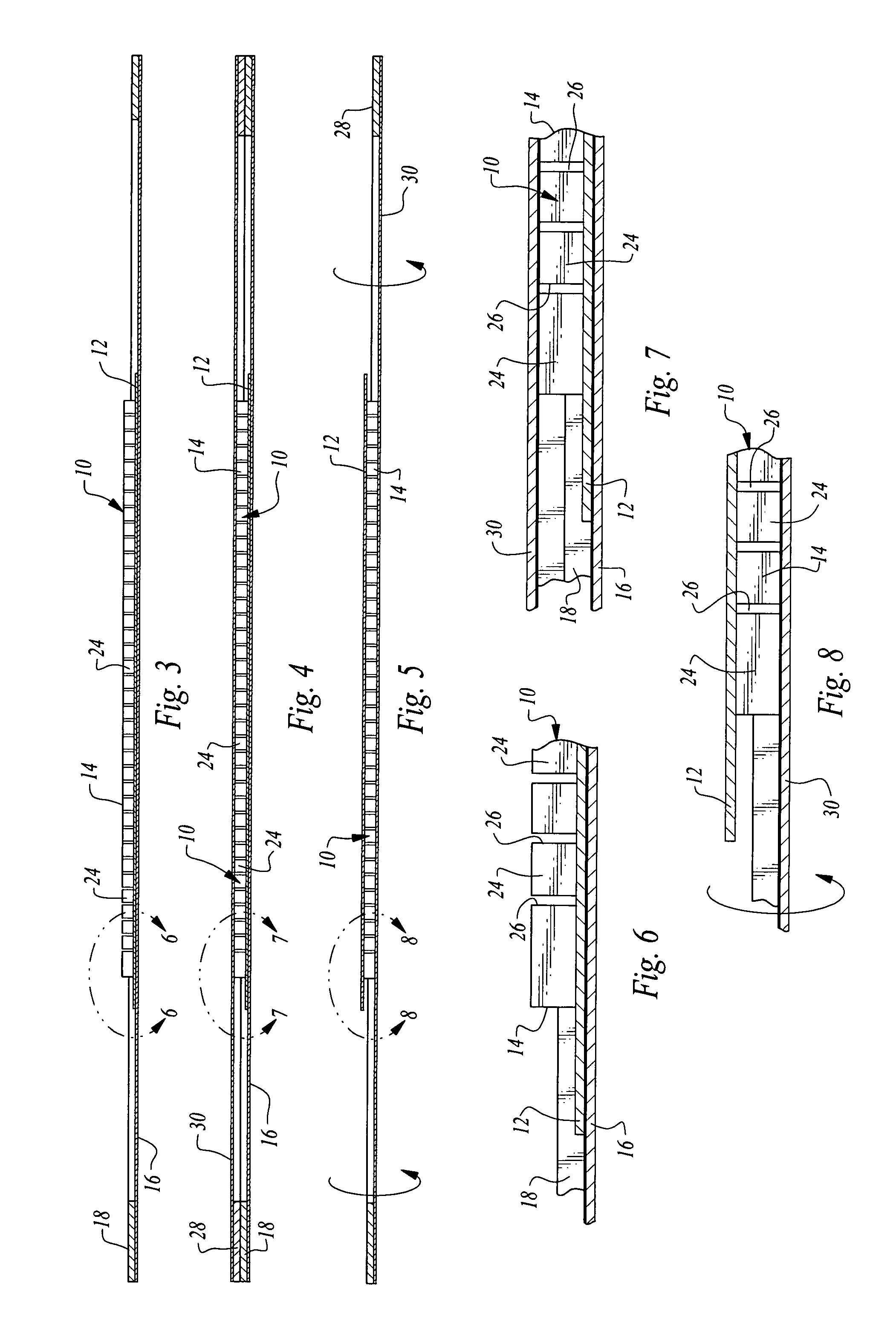 Method of removing back metal from an etched semiconductor scribe street