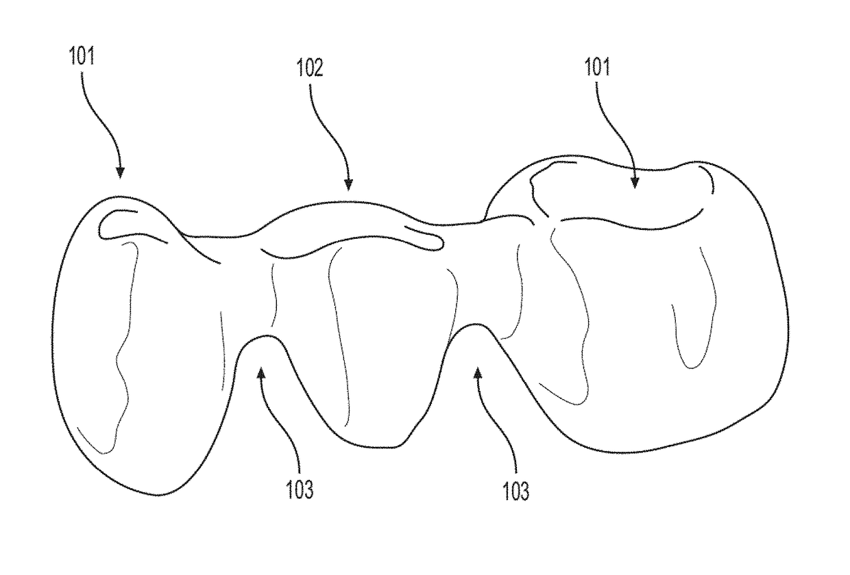 Method for producing a ceramic fixed partial denture