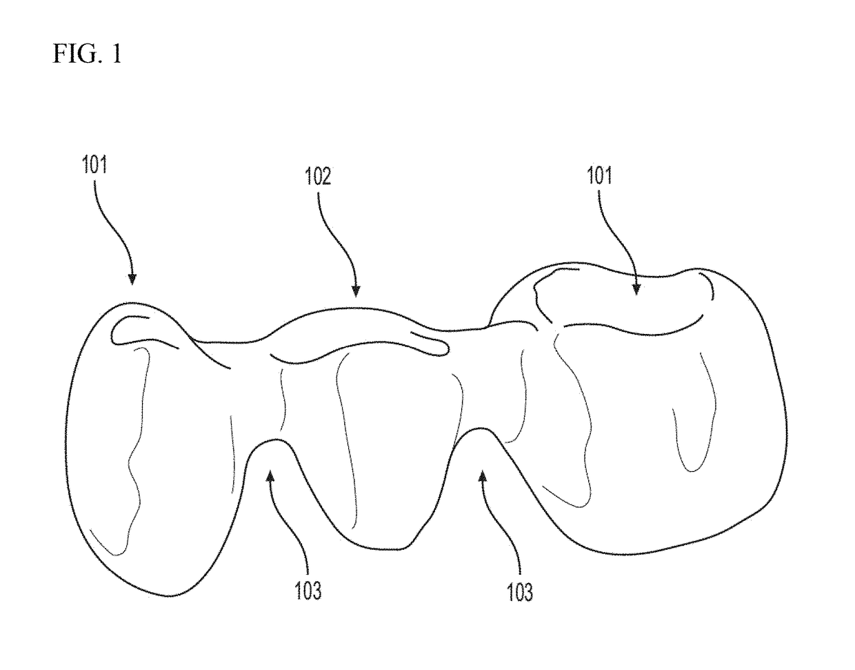 Method for producing a ceramic fixed partial denture