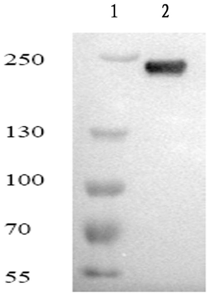 A fully human monoclonal antibody against complement c5 molecule and its application
