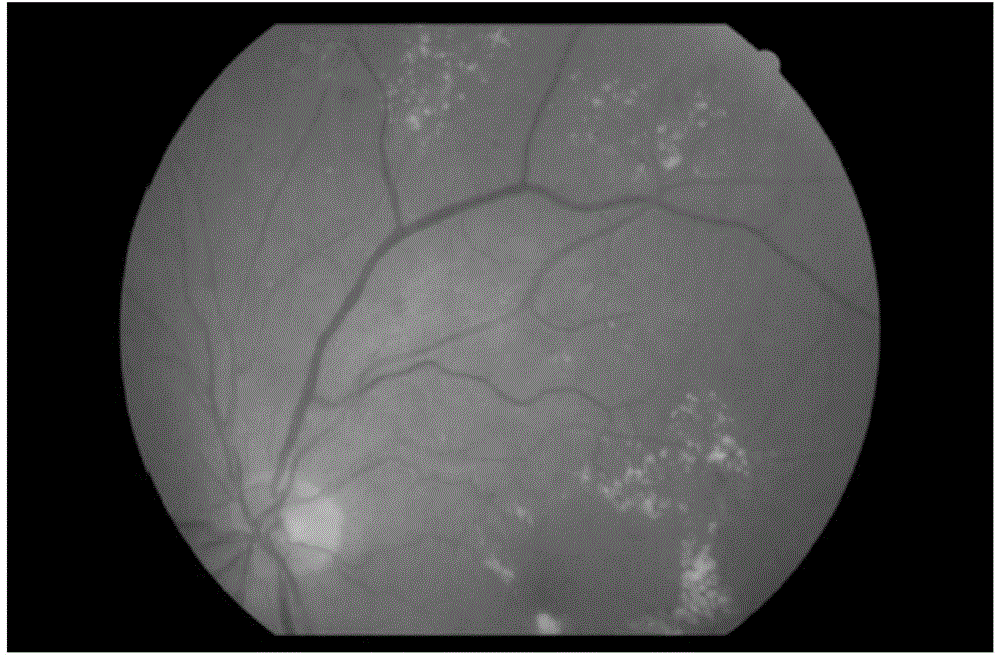 Arteriovenous retinal blood vessel classification method based on eye fundus image