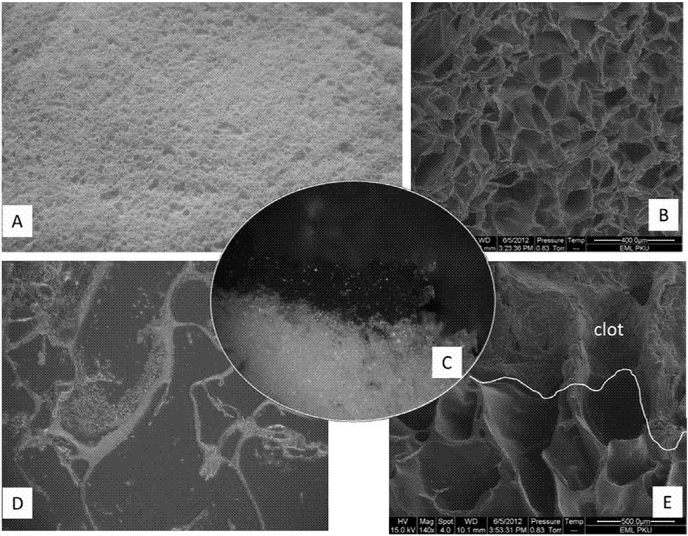 Macromolecule hydrogel dry glue sponge with super water absorption, and preparation method and application thereof