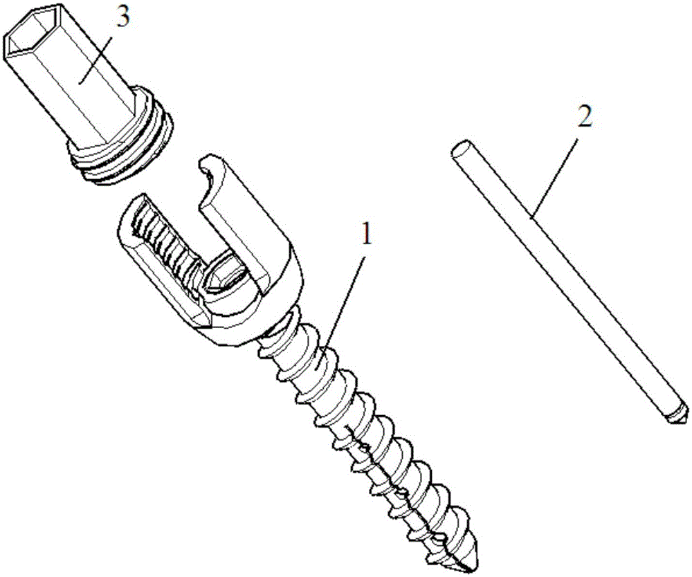 A multifunctional bone screw for poor bone condition