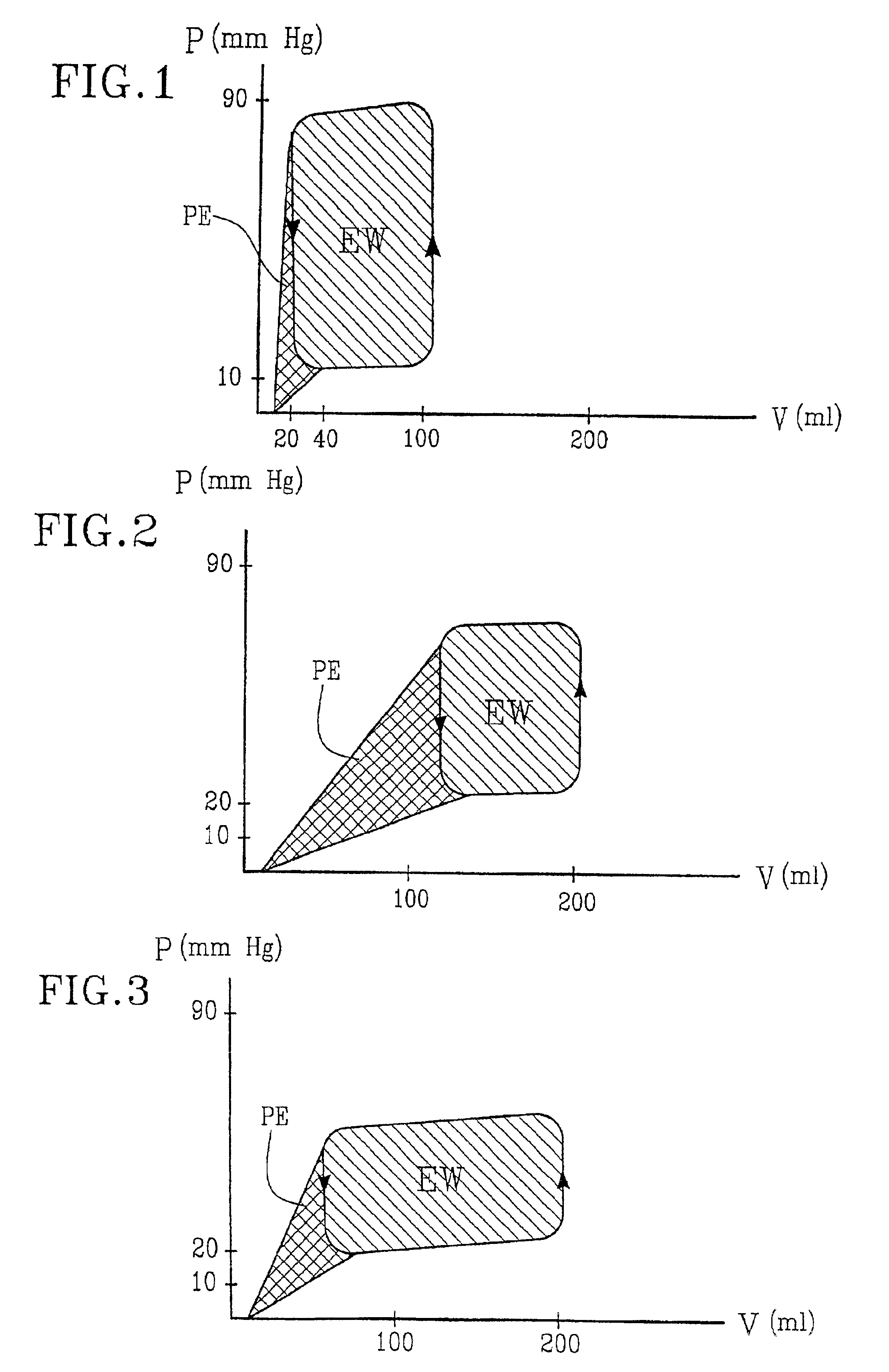 Implantable device for utilization of the hydraulic energy of the heart