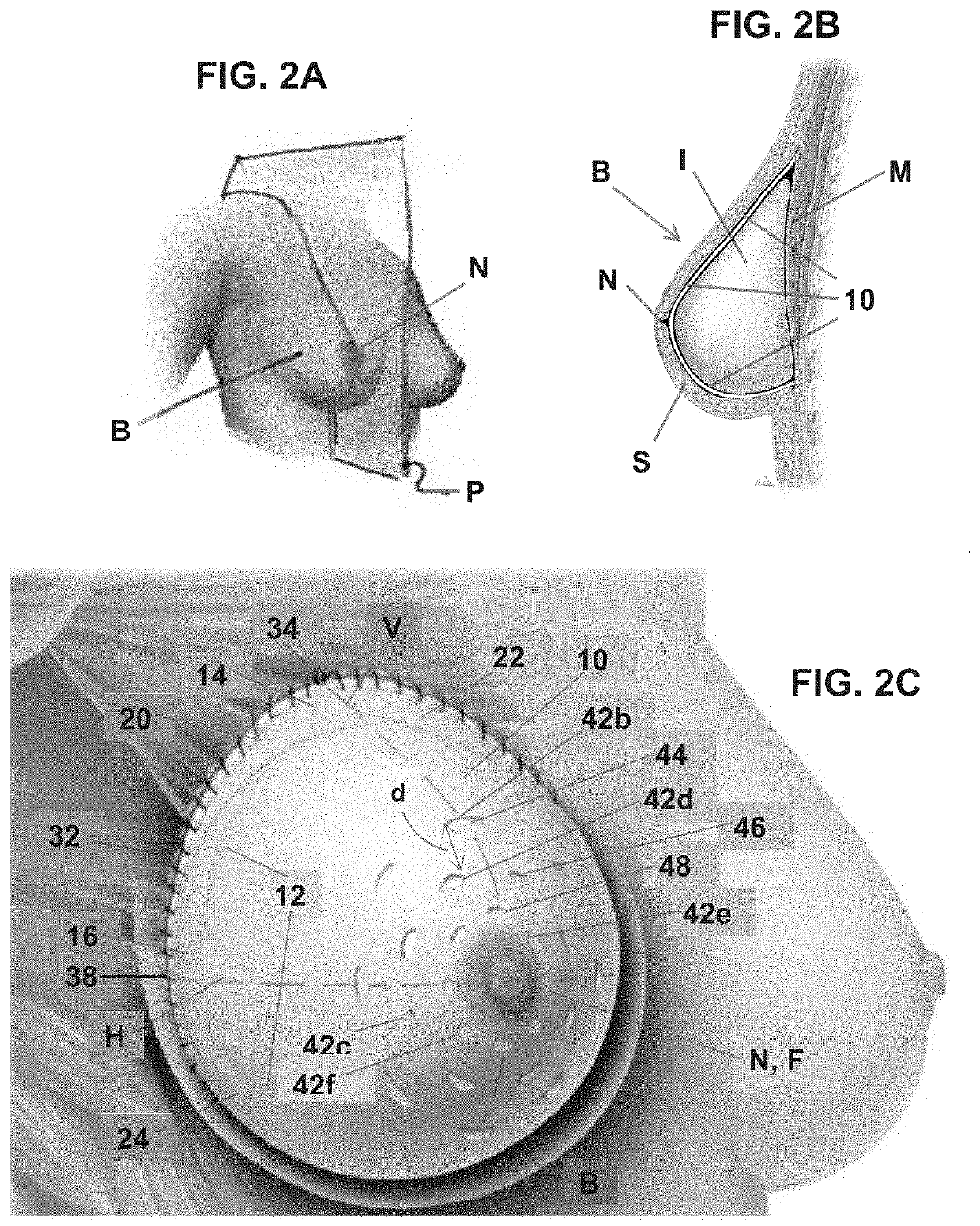 Soft tissue repair grafts and processes for preparing and using same