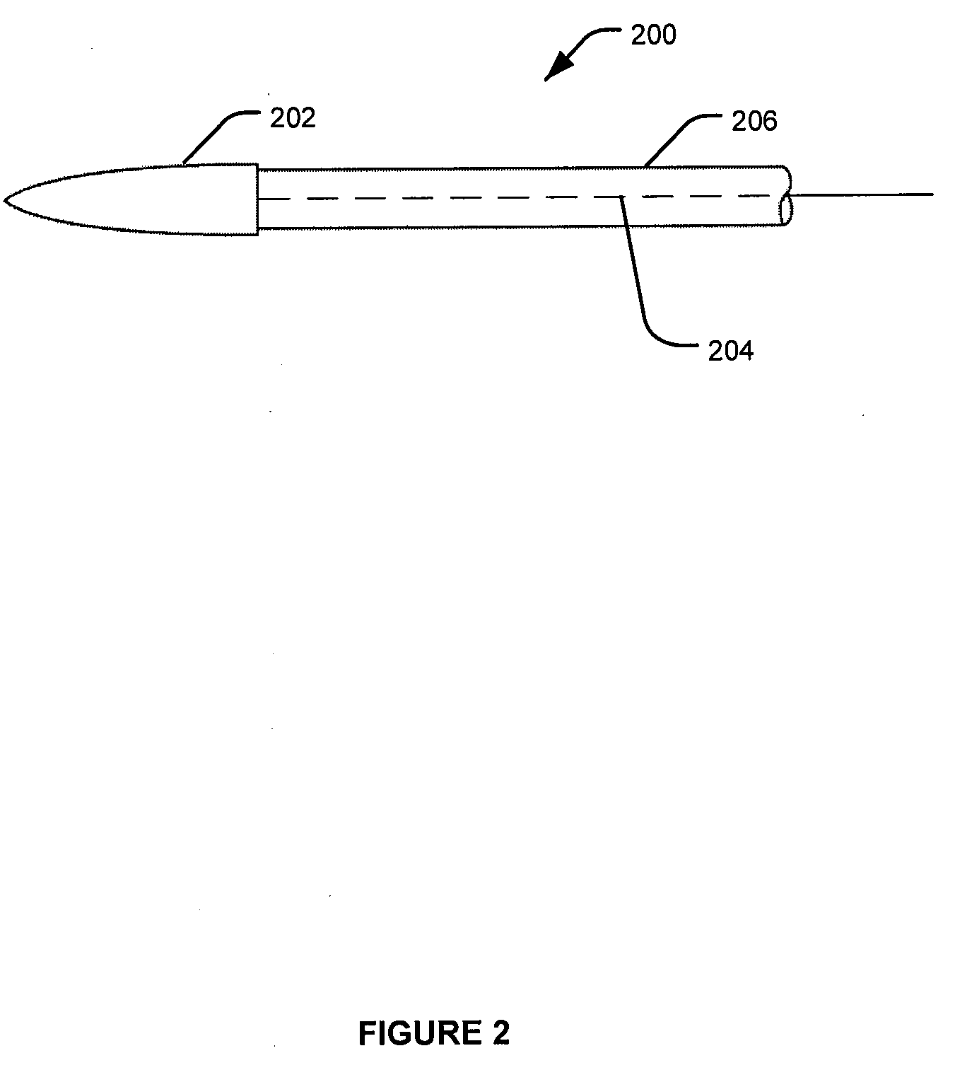 Fixation and alignment device and method used in orthopaedic surgery