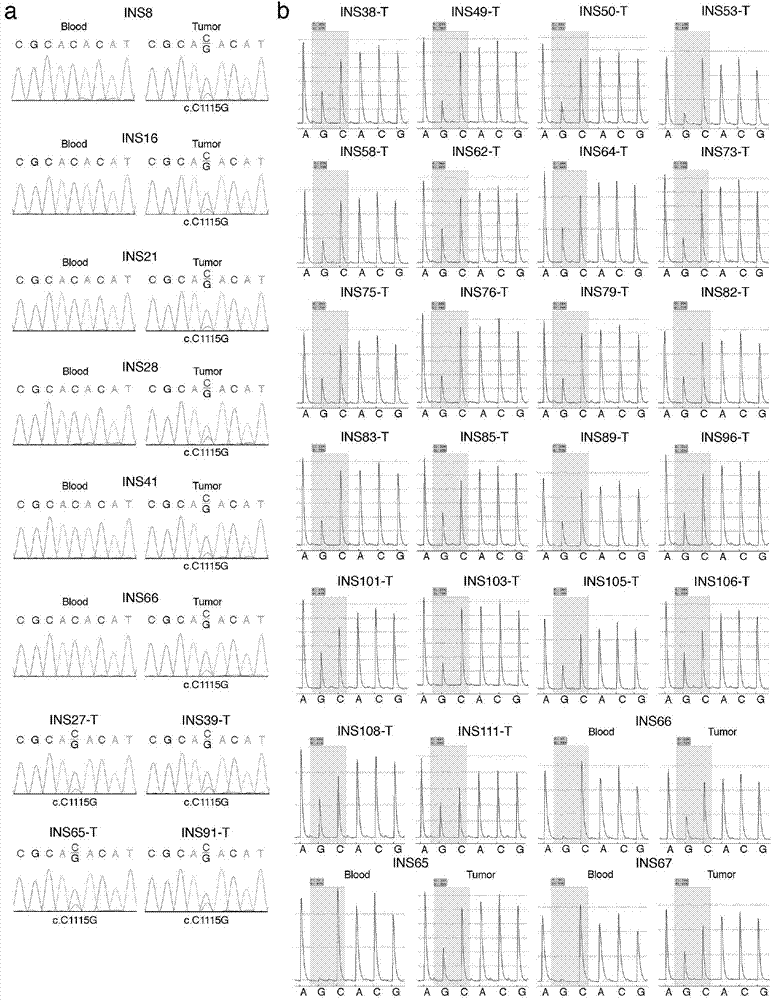 Pancreatic neuroendocrine tumor susceptibility gene site, and detection method and kit thereof