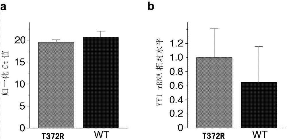 Pancreatic neuroendocrine tumor susceptibility gene site, and detection method and kit thereof