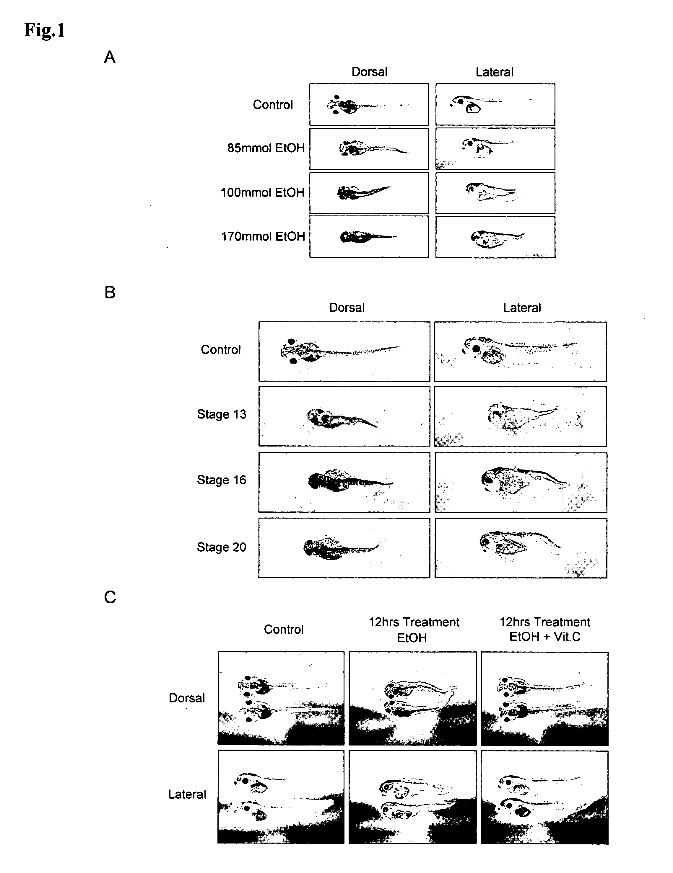 Animal model for fetal alcohol syndrome and methods of treatment