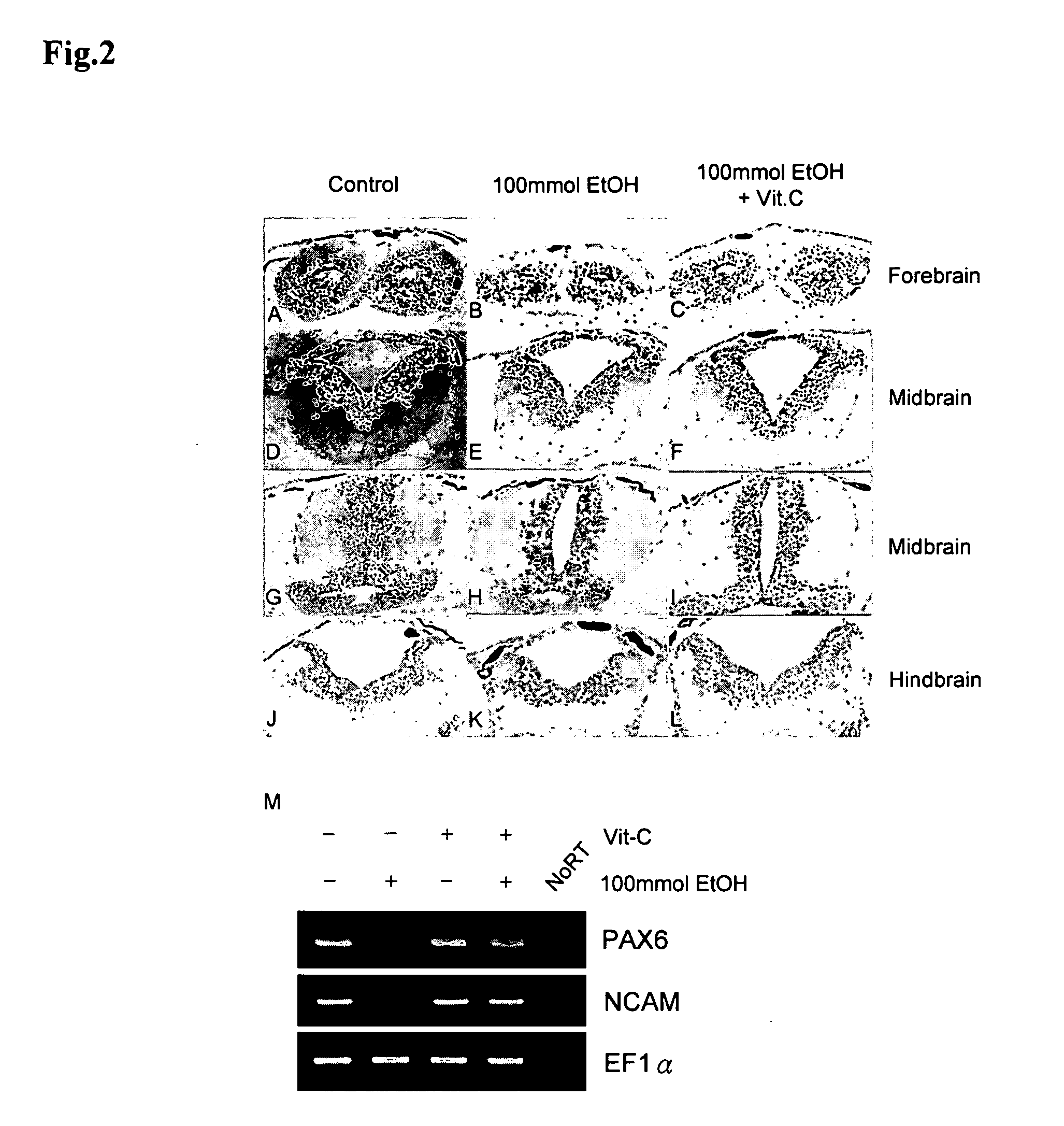 Animal model for fetal alcohol syndrome and methods of treatment