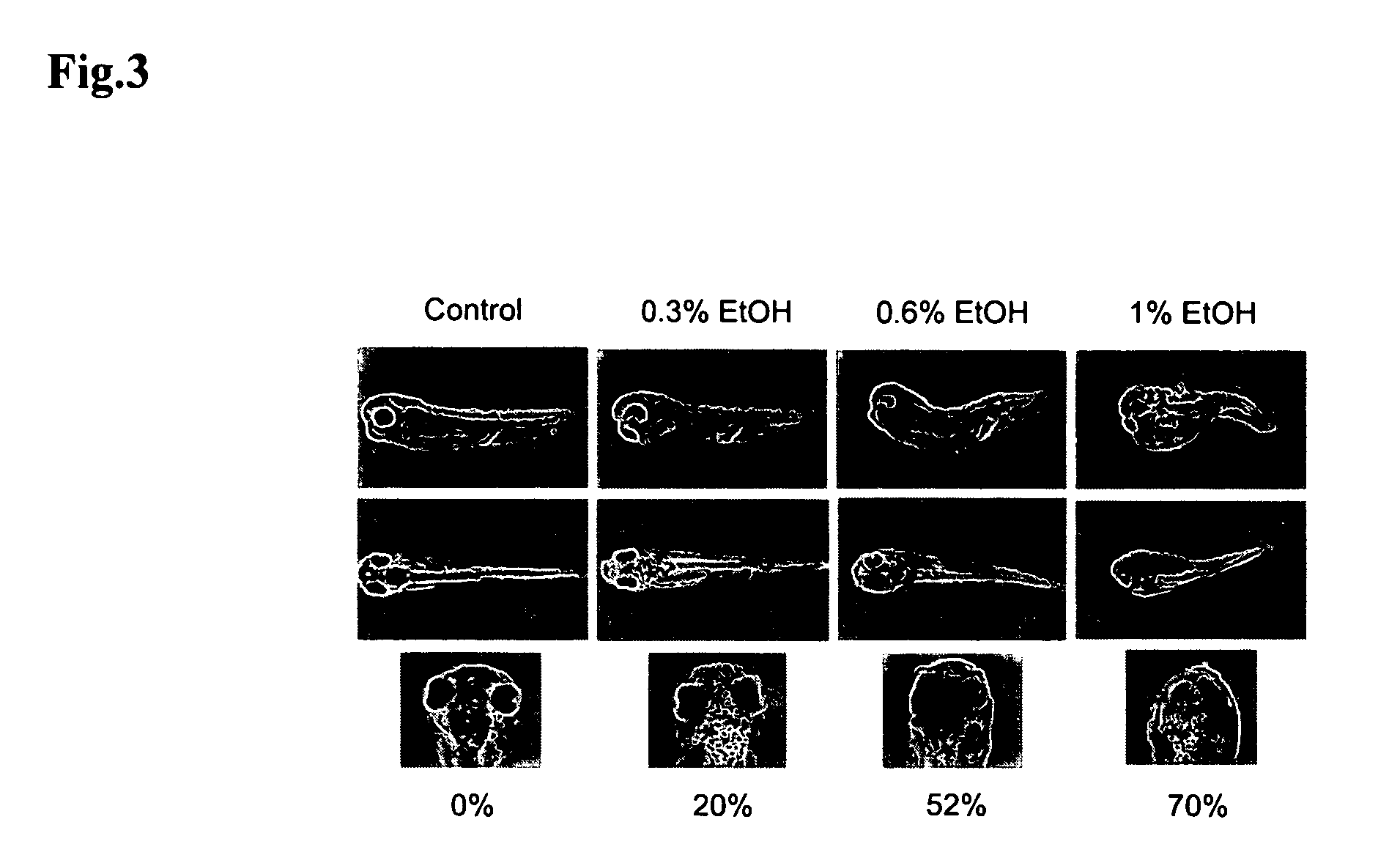 Animal model for fetal alcohol syndrome and methods of treatment