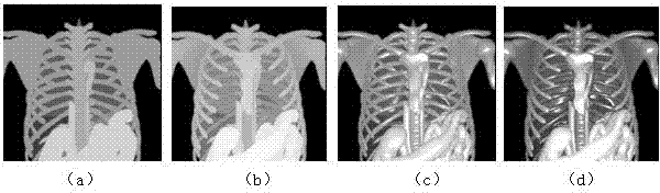 Maxim intensity projection method based on enhanced visual perception