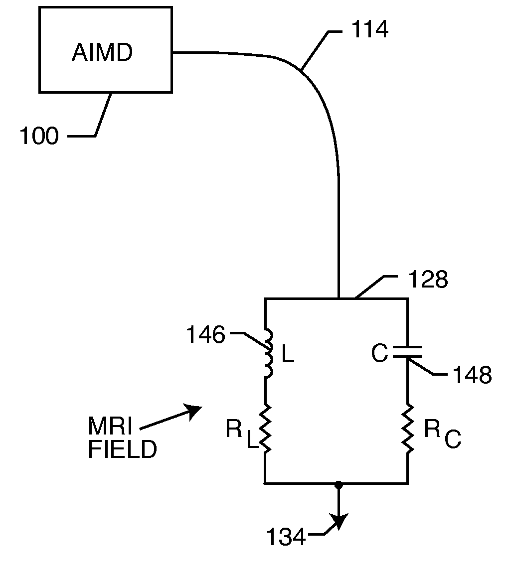 Capacitor and inductor elements physically disposed in series whose lumped parameters are electrically connected in parallel to form a bandstop filter