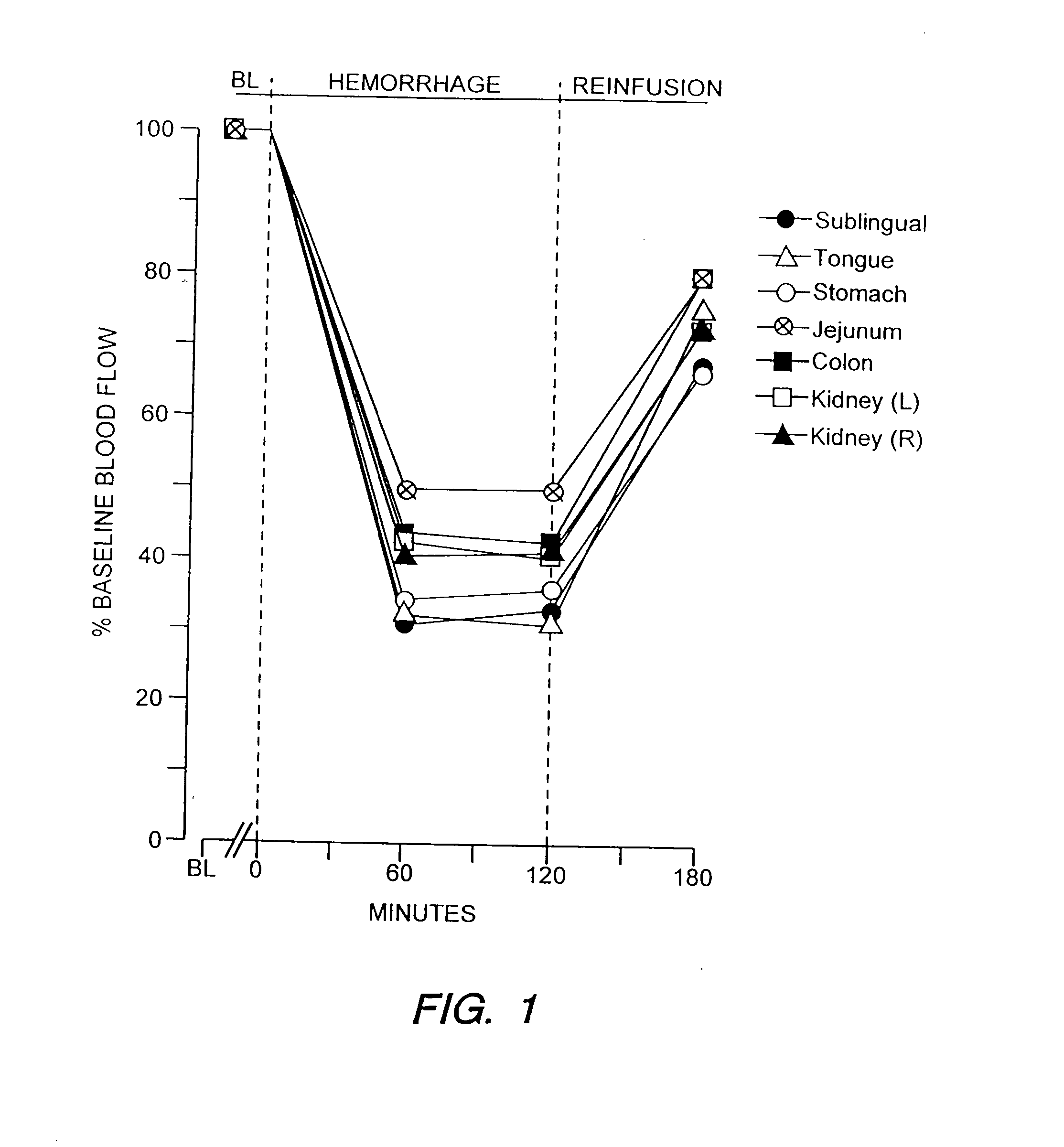 Device for Assessing Perfusion Failure in a Patient by Measurement of Blood Flow