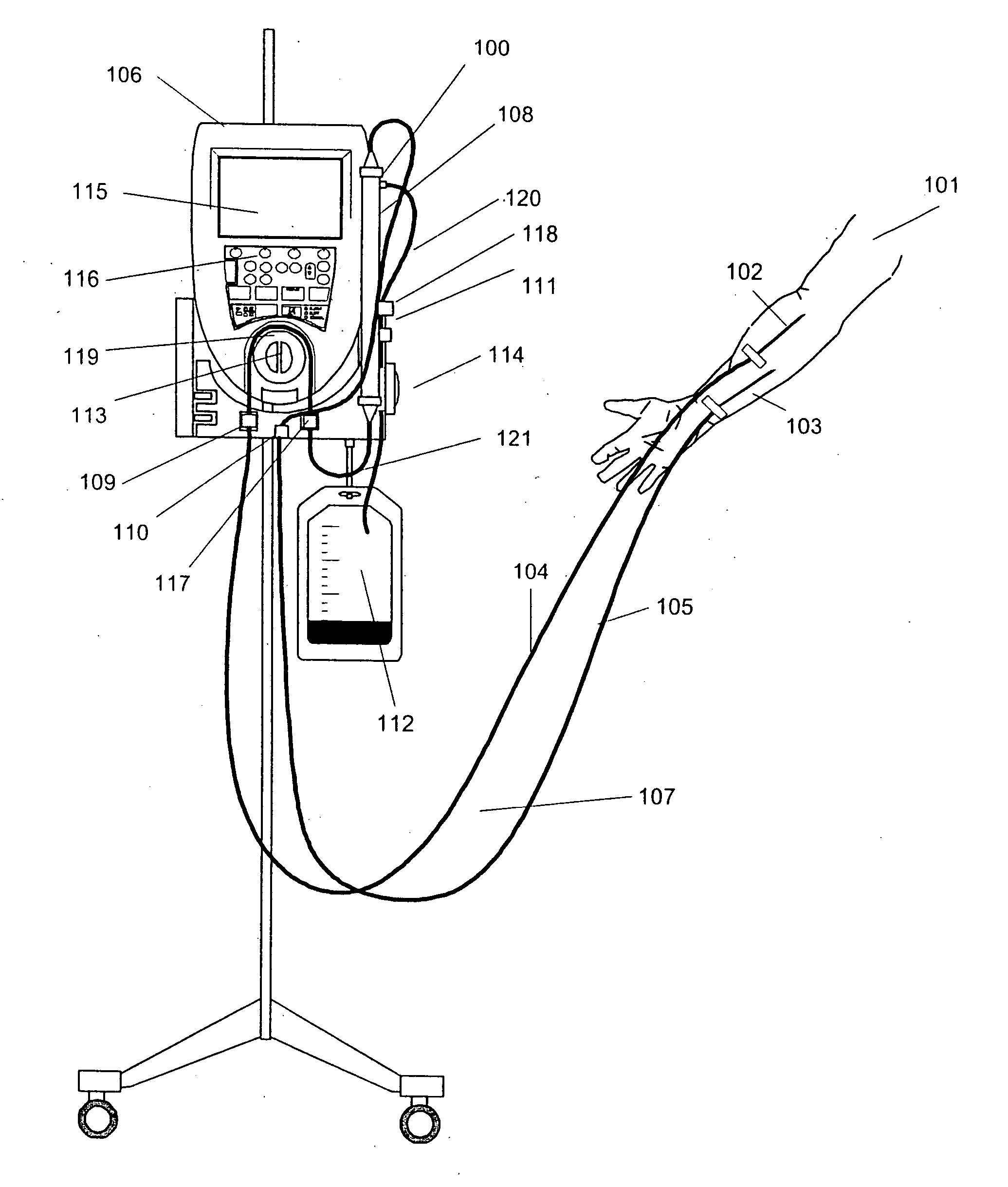 Method to control blood and filtrate flowing through an extracorporeal device