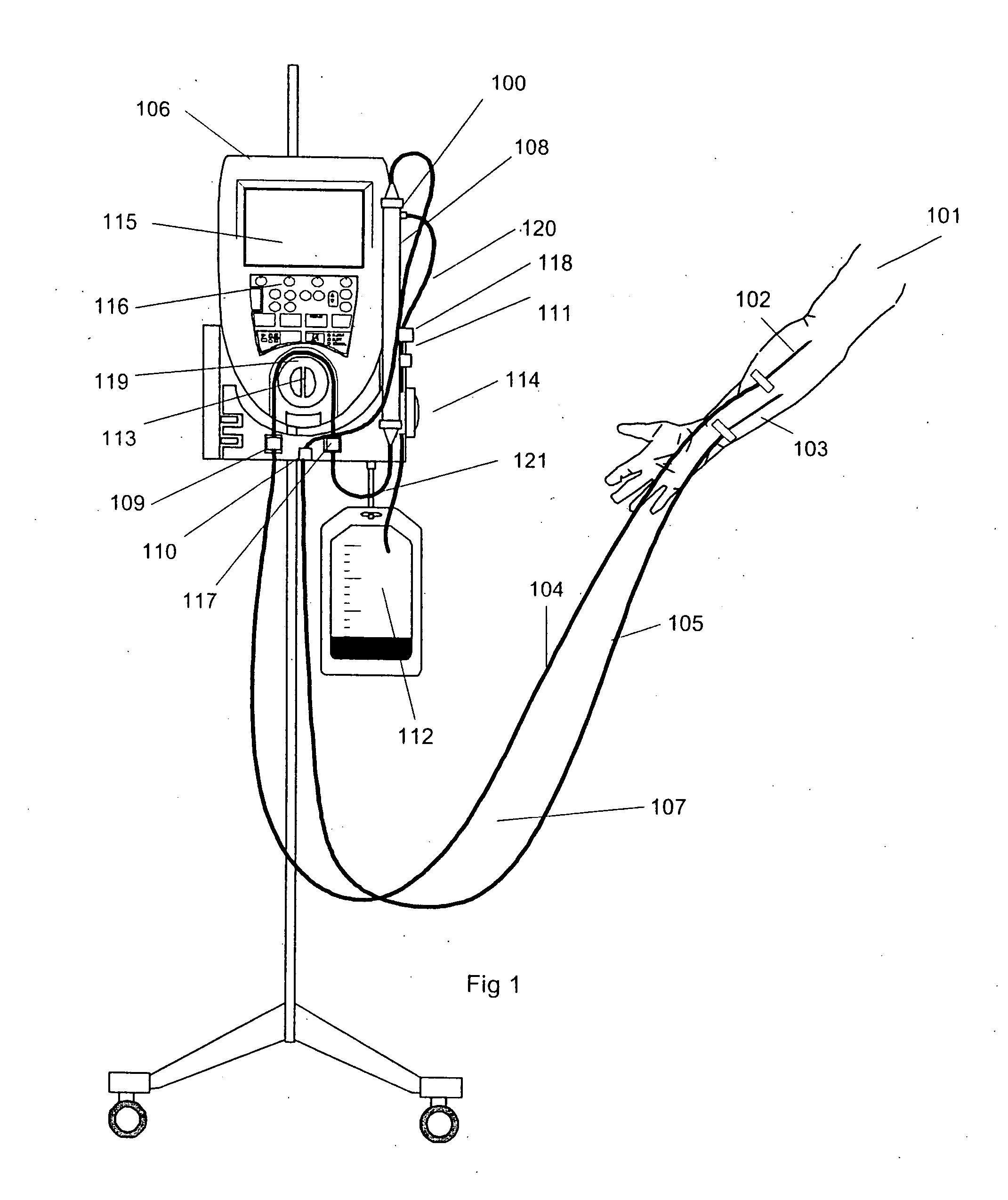 Method to control blood and filtrate flowing through an extracorporeal device