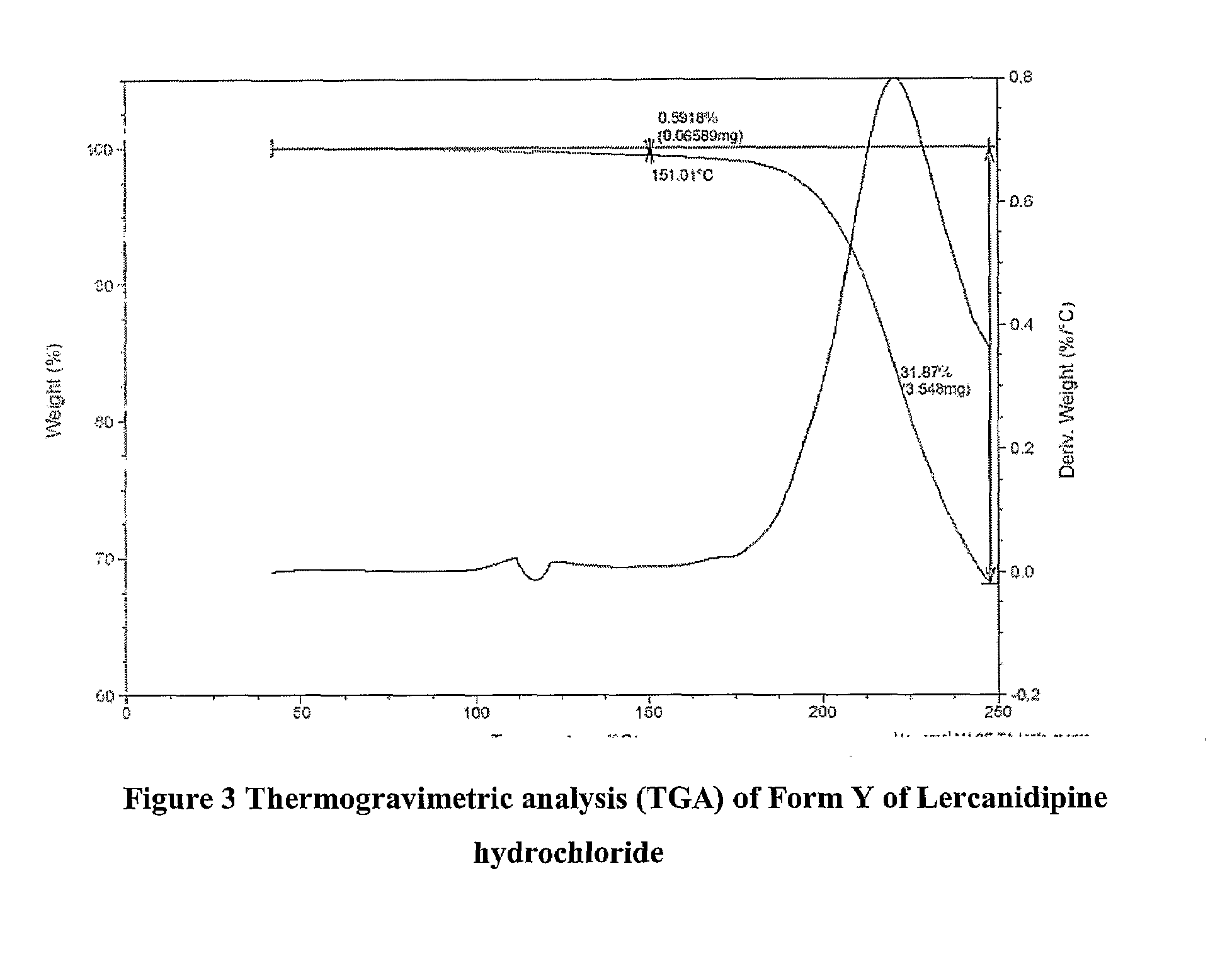 Lercanidipine Hydrochloride Polymorphs and an Improved Process for Preparation of 1,1,N-Trimethyl-N-(3,3-Diphenylpropyl)-2-Aminoethyl Acetoacetate