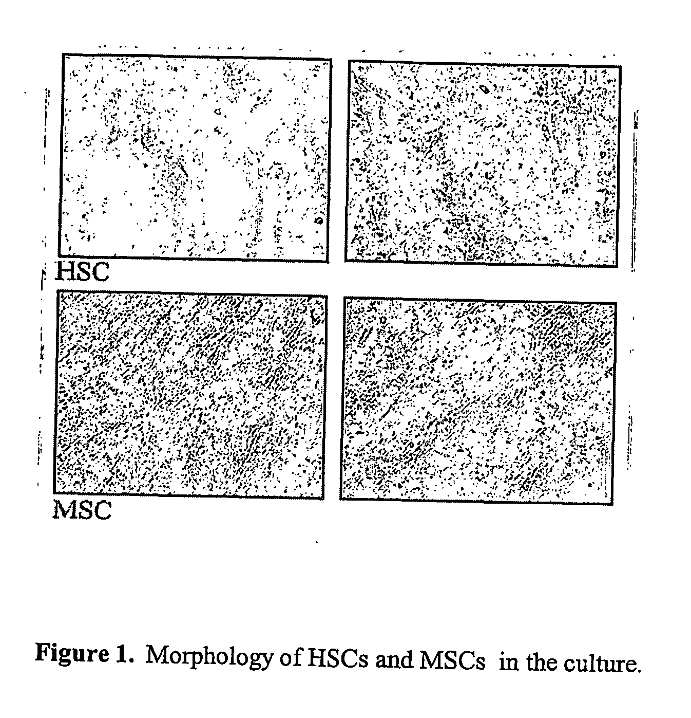 Method for transdifferentiation of non-pancreatic stem cells to the pancreatic pathway