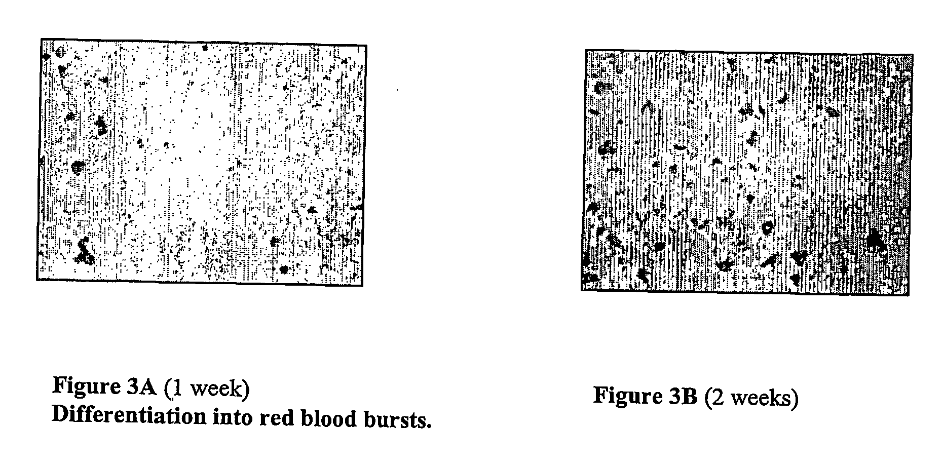 Method for transdifferentiation of non-pancreatic stem cells to the pancreatic pathway