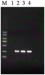 Kit and extraction method for extracting bacterial genome dna by magnetic bead method