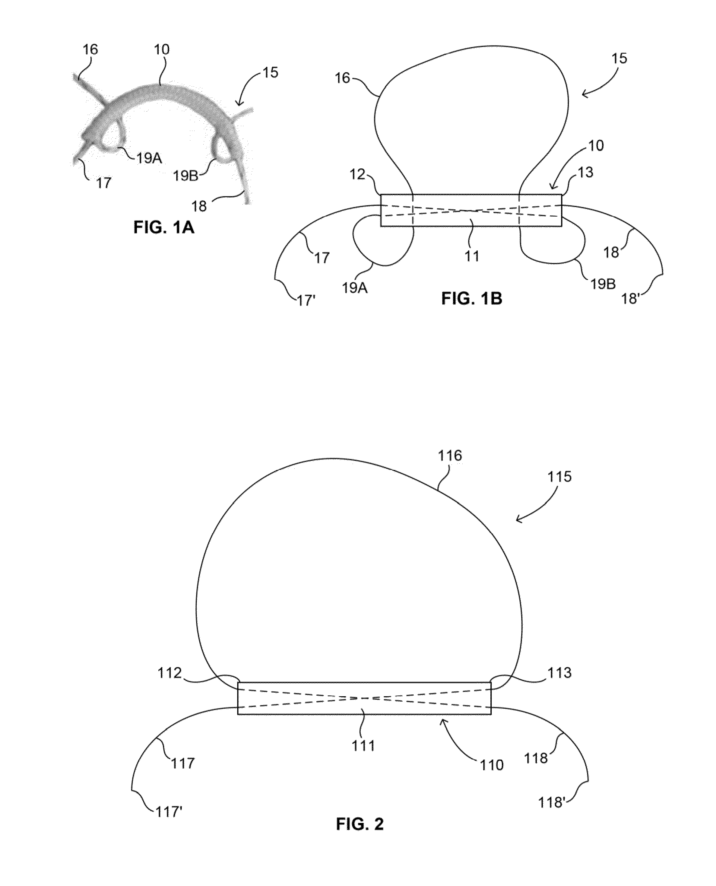 Soft tissue fixation devices and methods