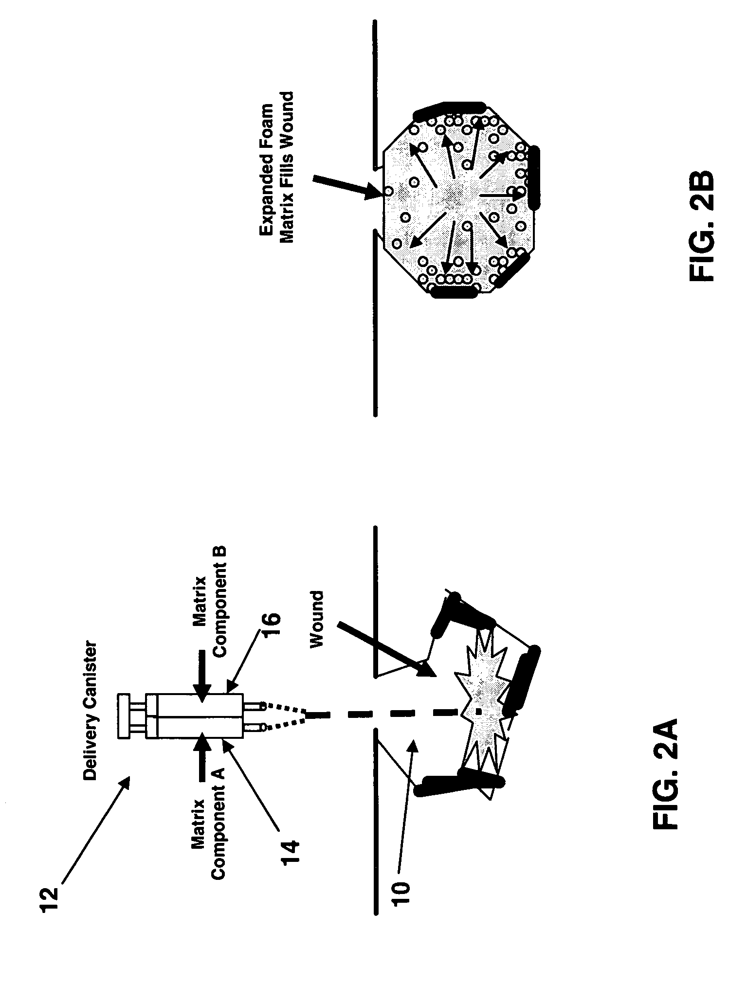 Method and composition for in situ formation of an artificial blockage to control bleeding