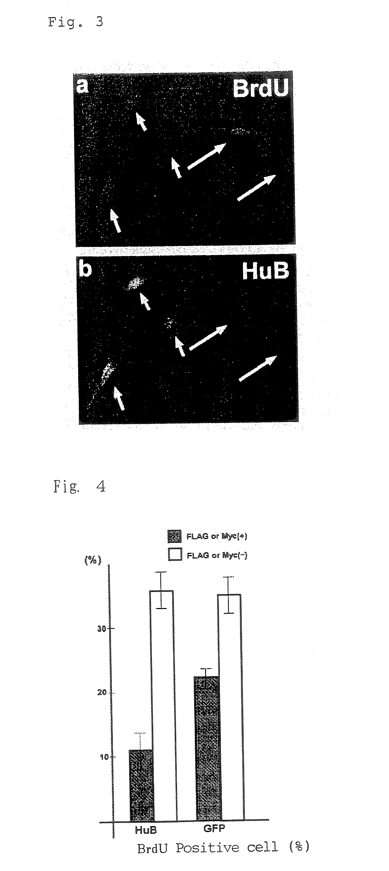 Therapeutic agent for tumor of neural origin