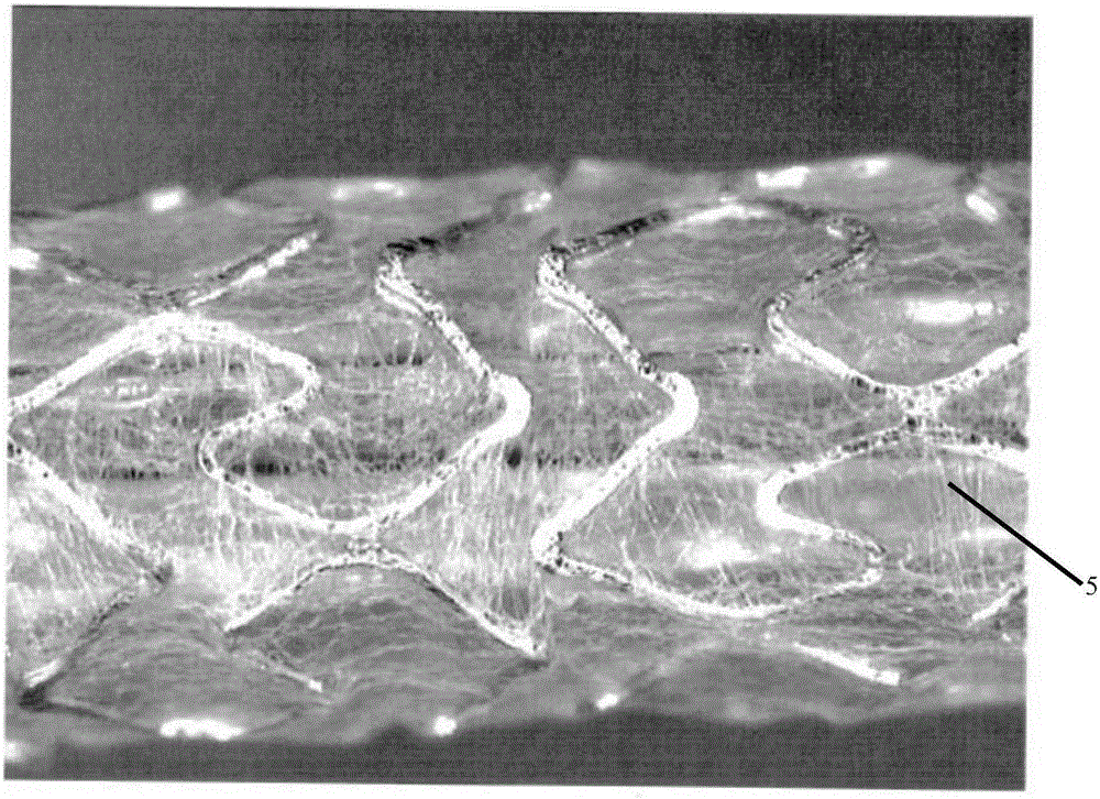 Helical hybrid stent