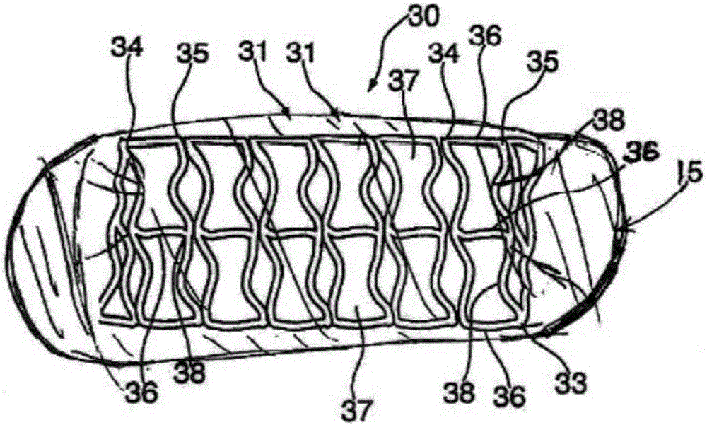 Helical hybrid stent