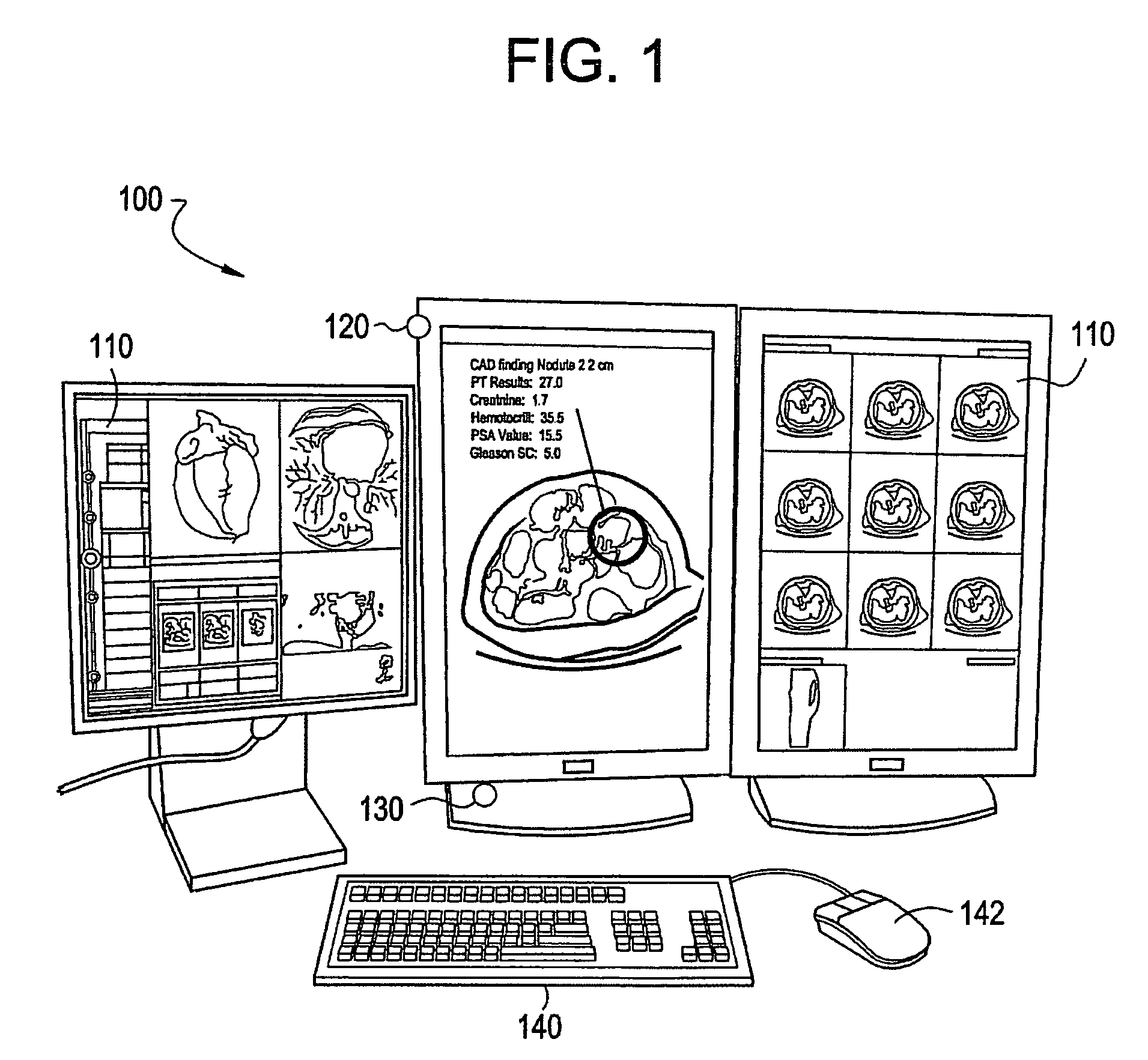 System and method for significant image selection using visual tracking