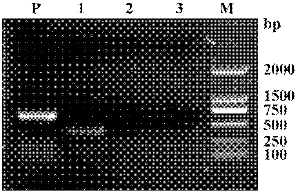 Dominant sequence of delta 1 chain complementary determining region (CDR) 3 in gamma delta T lymphocytes, and T cell receptor (TCR) transfected cells and application thereof