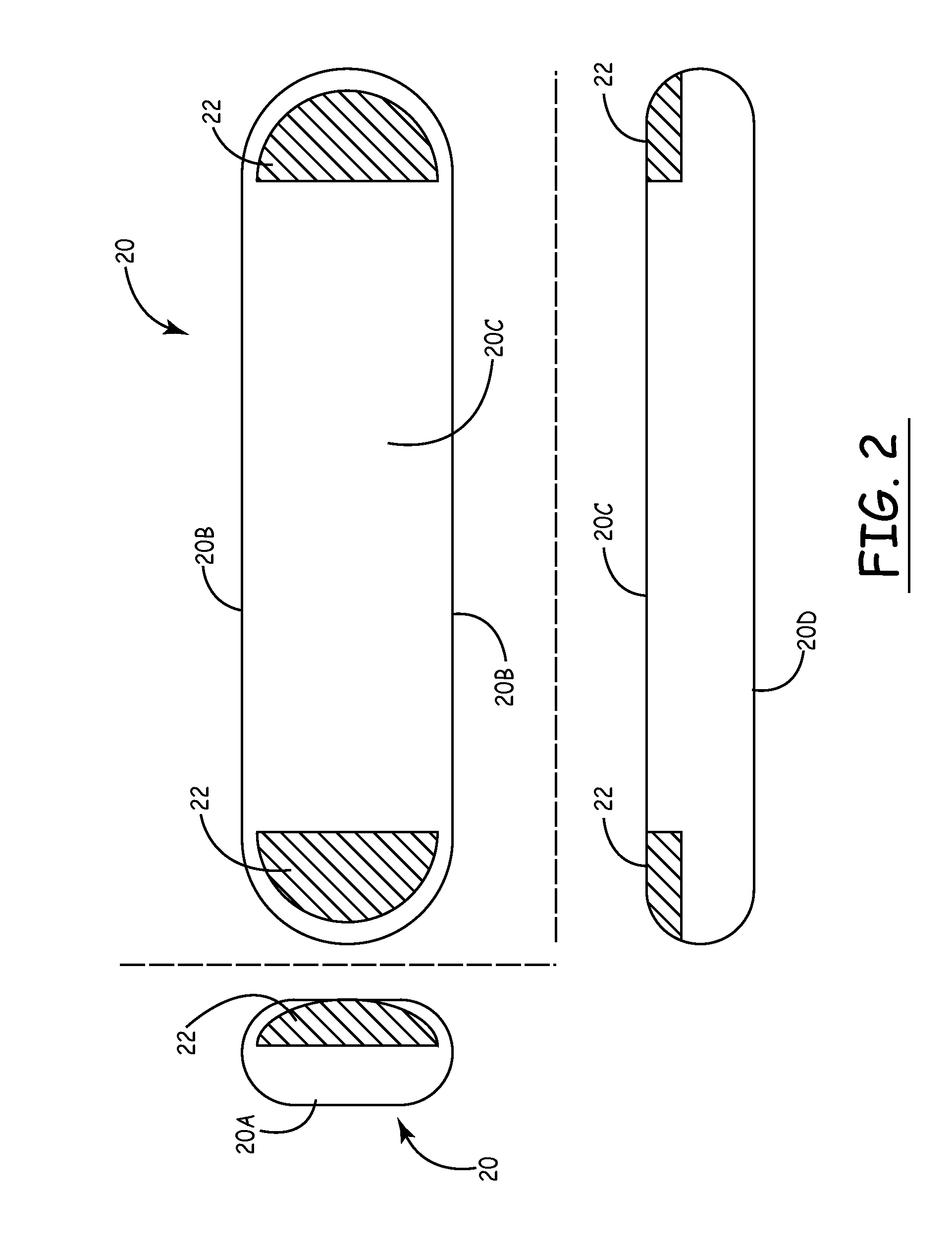 Electrode shapes and positions for reducing loss of contact in an implantable ECG recorder
