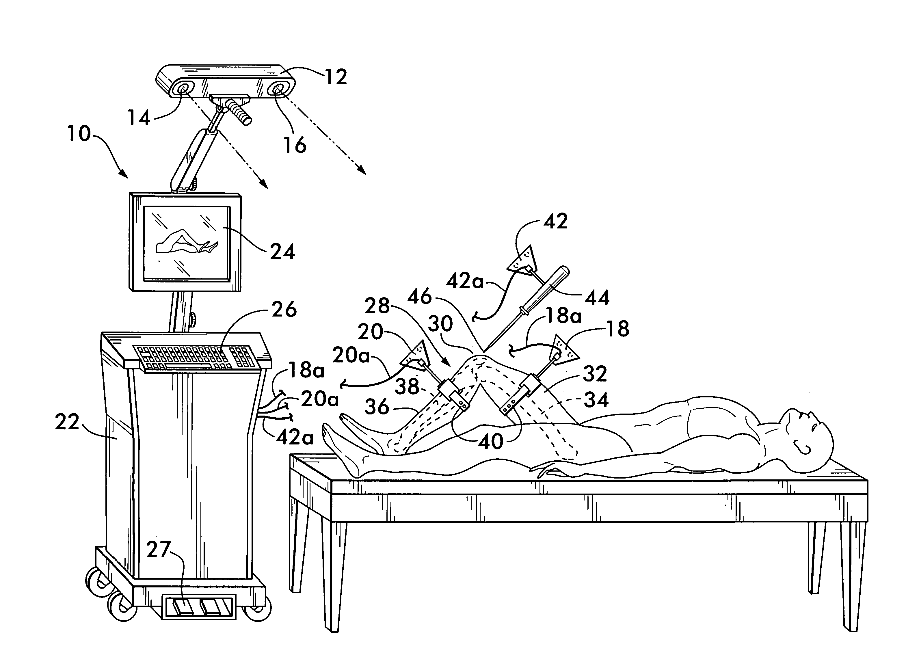 Method of determining the position of the articular point of a joint