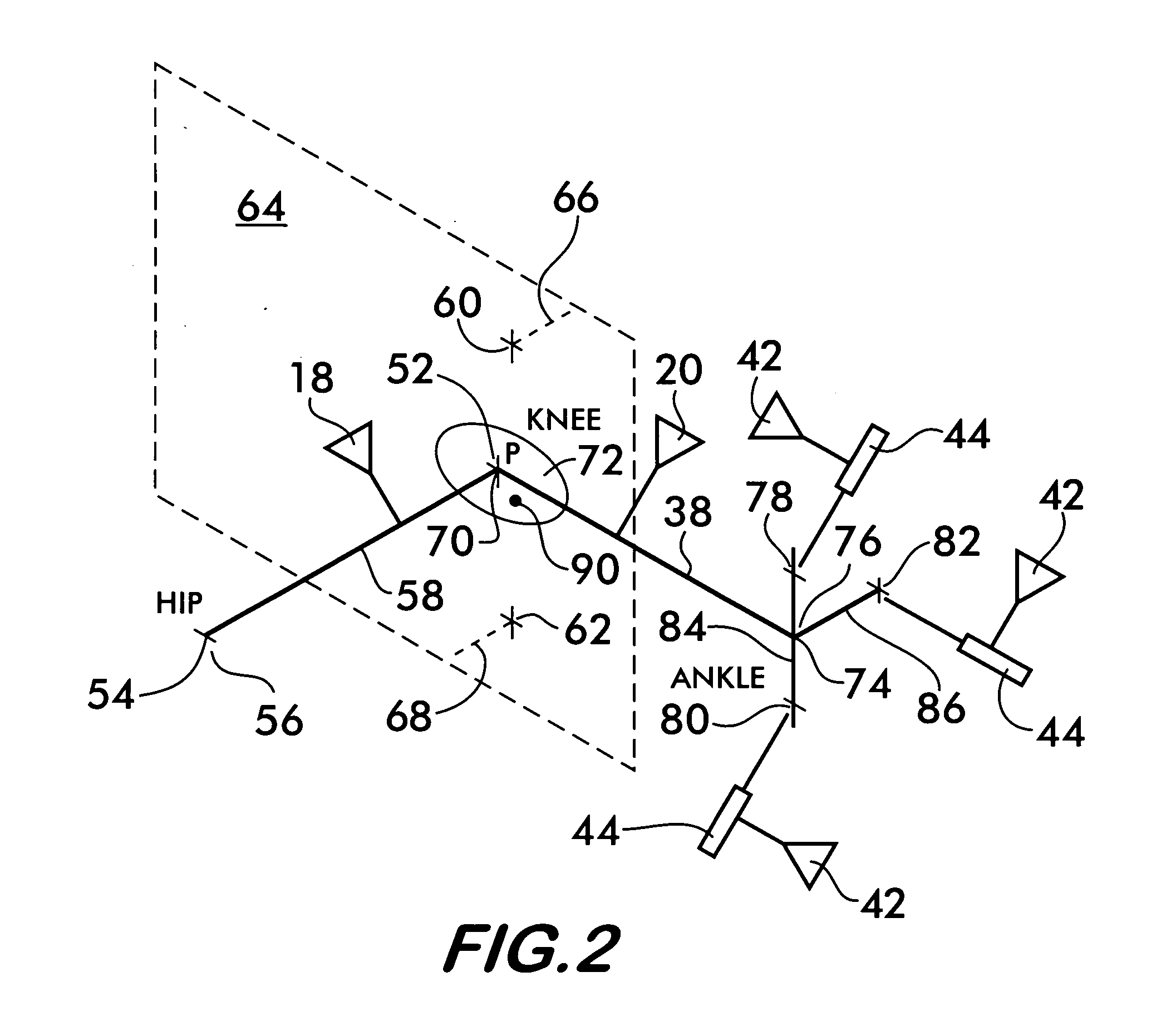 Method of determining the position of the articular point of a joint