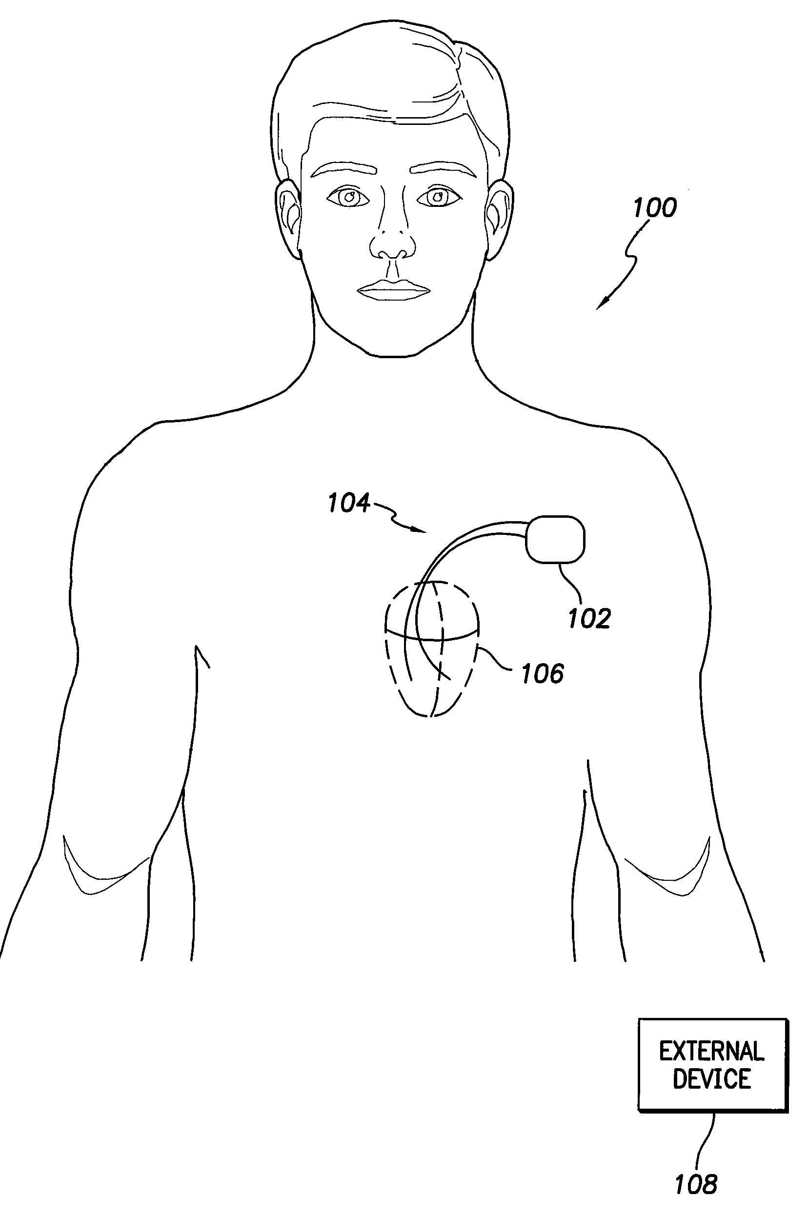 System and method for identifying a potential cause of pulmonary edema