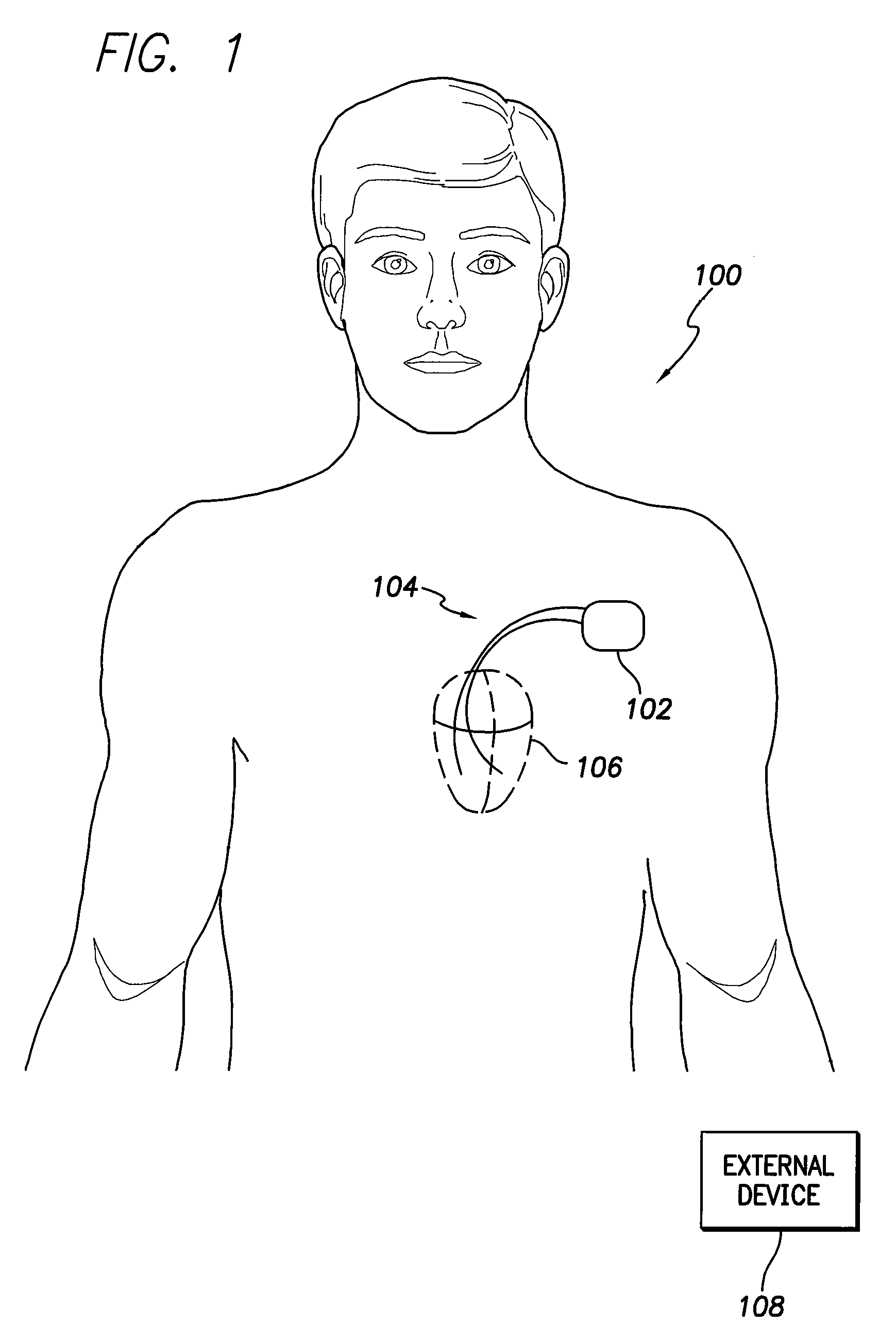 System and method for identifying a potential cause of pulmonary edema