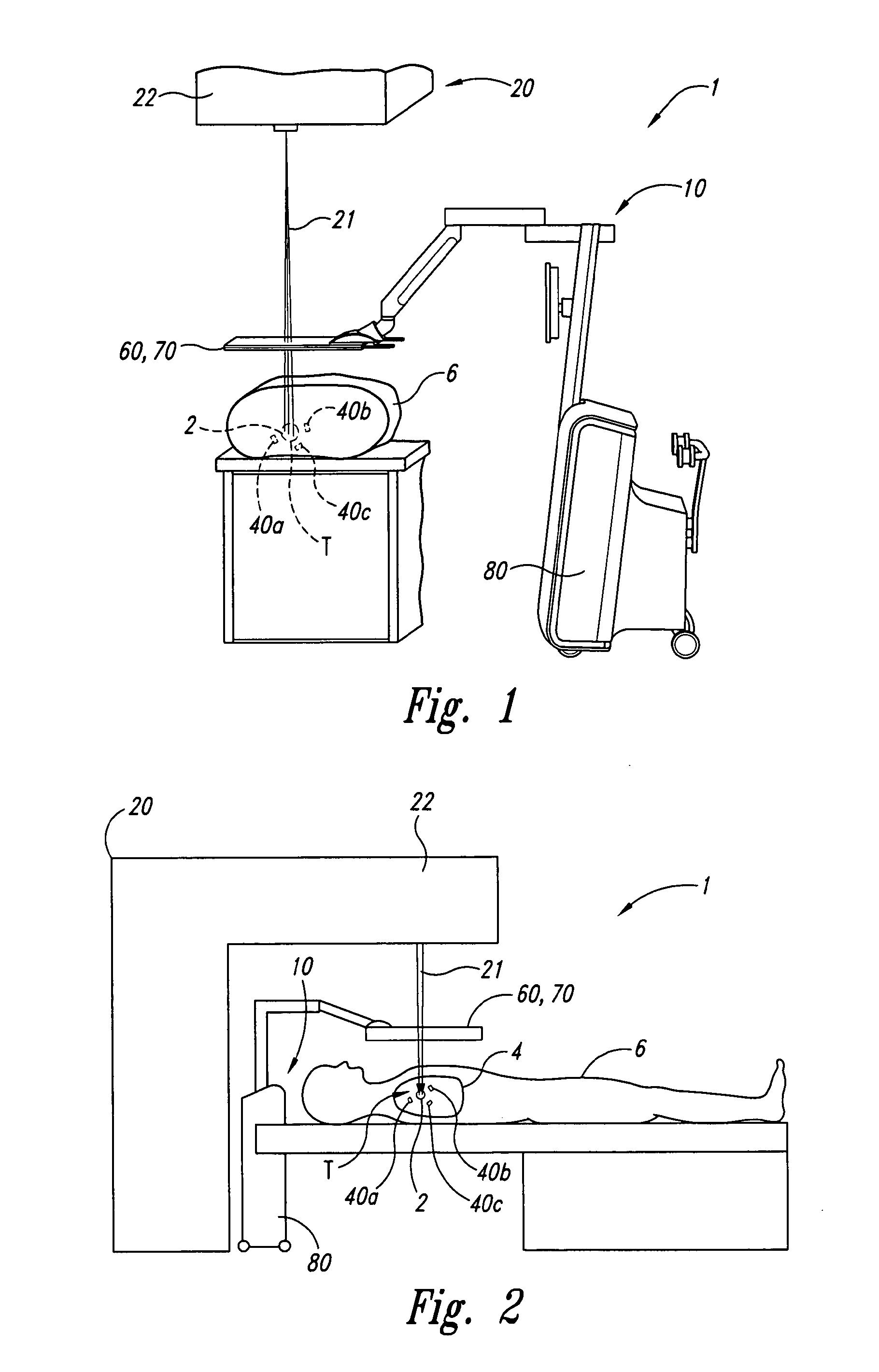Systems and methods for real-time tracking of targets in radiation therapy and other medical applications