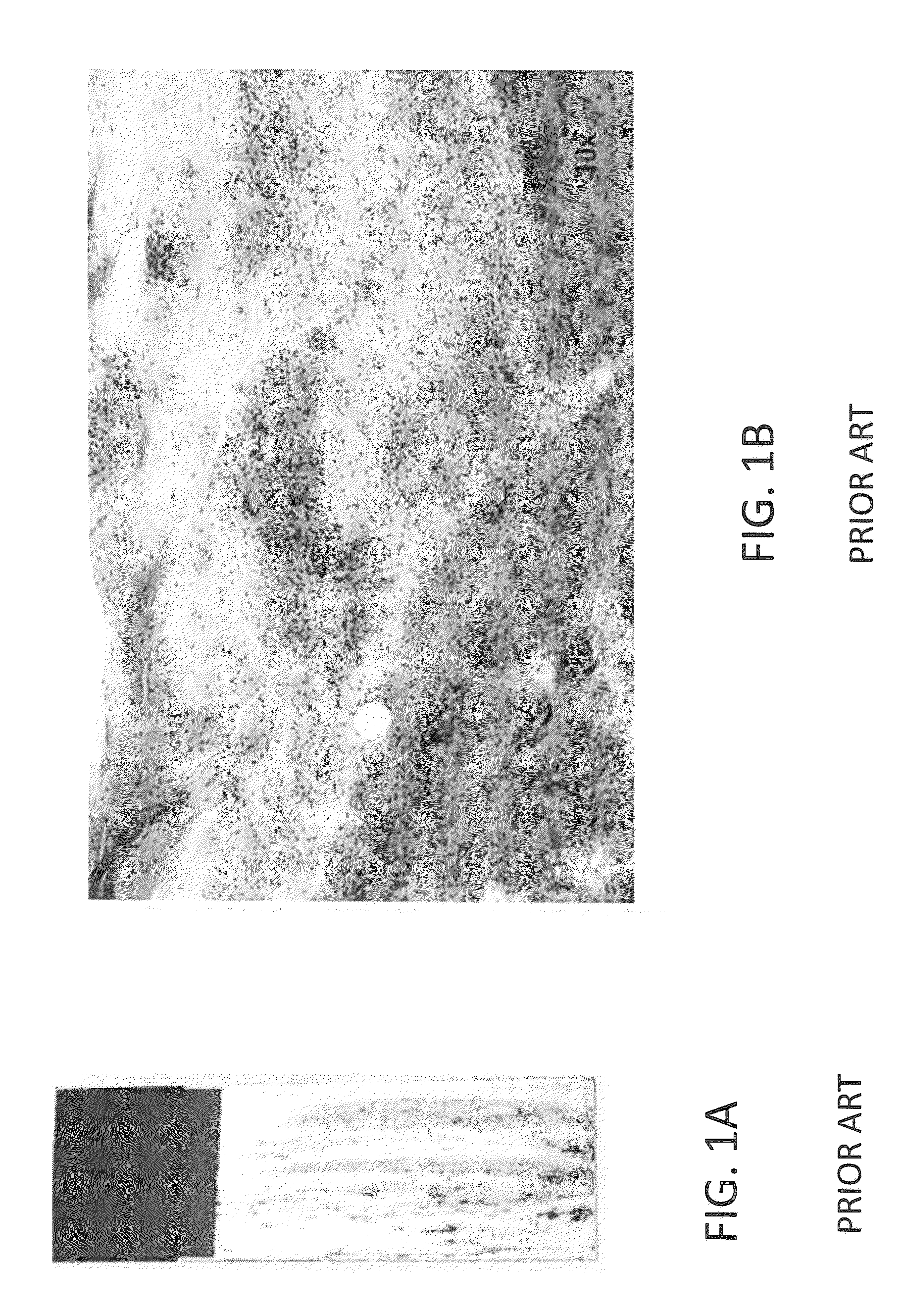 Method and system for analyzing biological specimens by spectral imaging