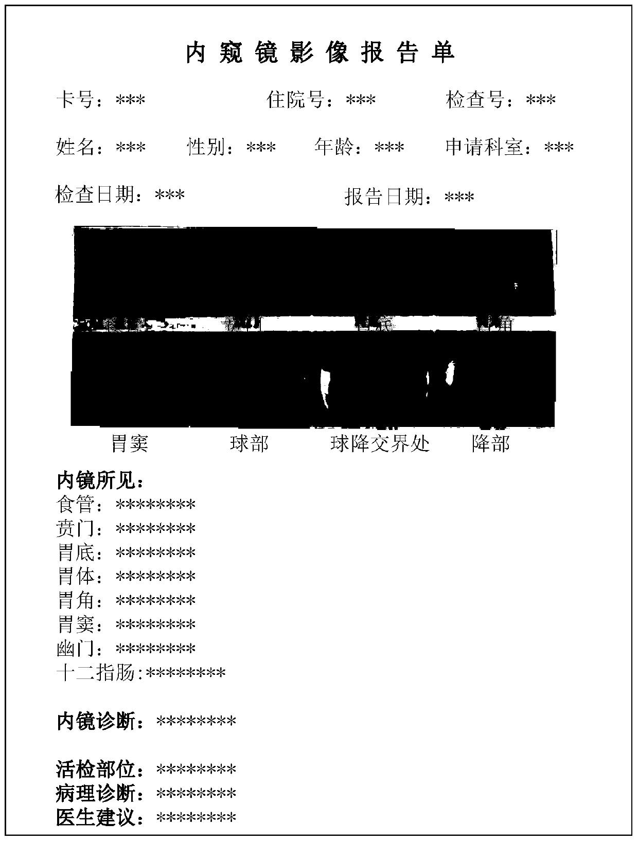 Image report generation method and device, terminal and storage medium